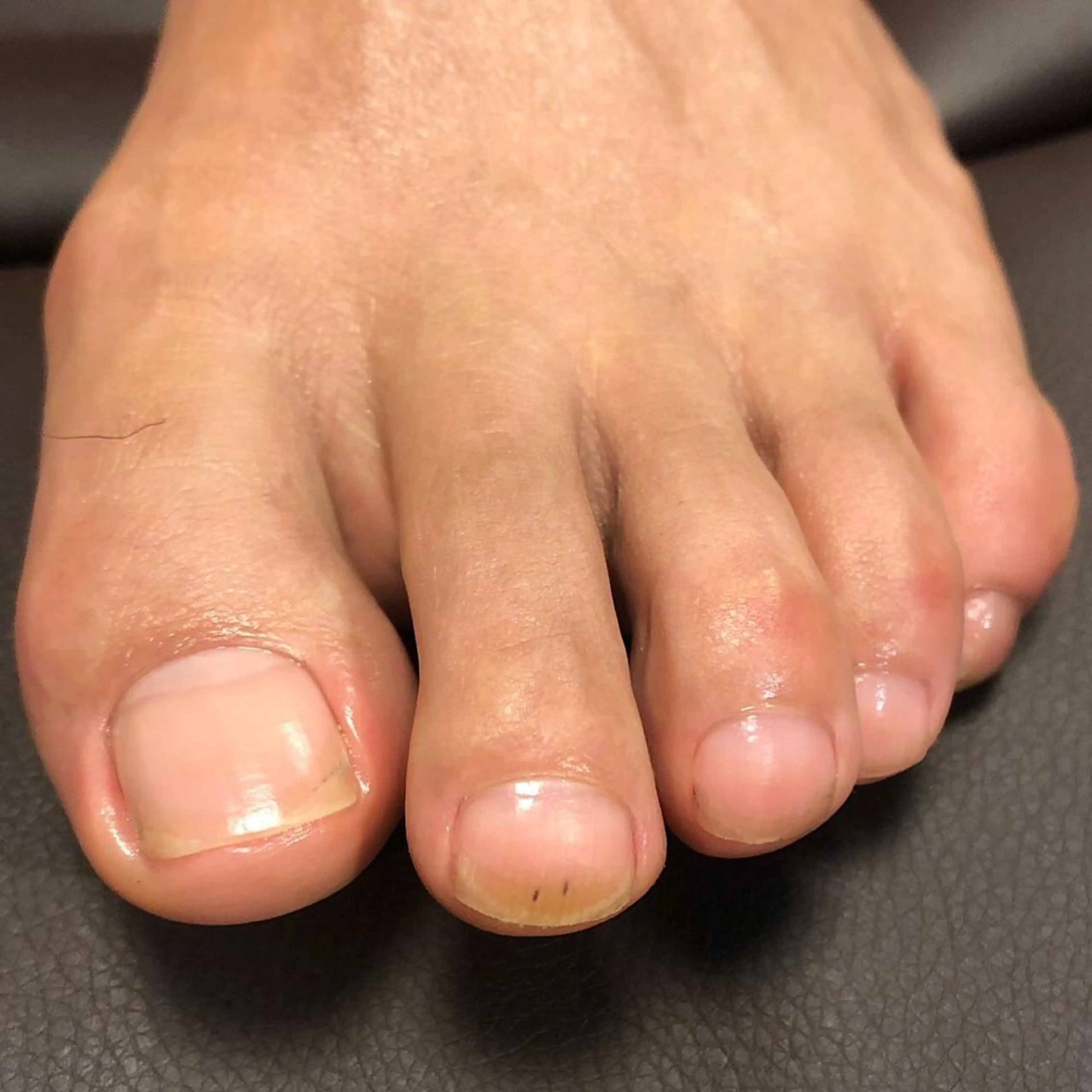 ショート カラー メンズ ネイル フットケアサロンすりーぴんぐ田端店所属・🌱 ま　し　お　🌱のエステ・リラクイメージ