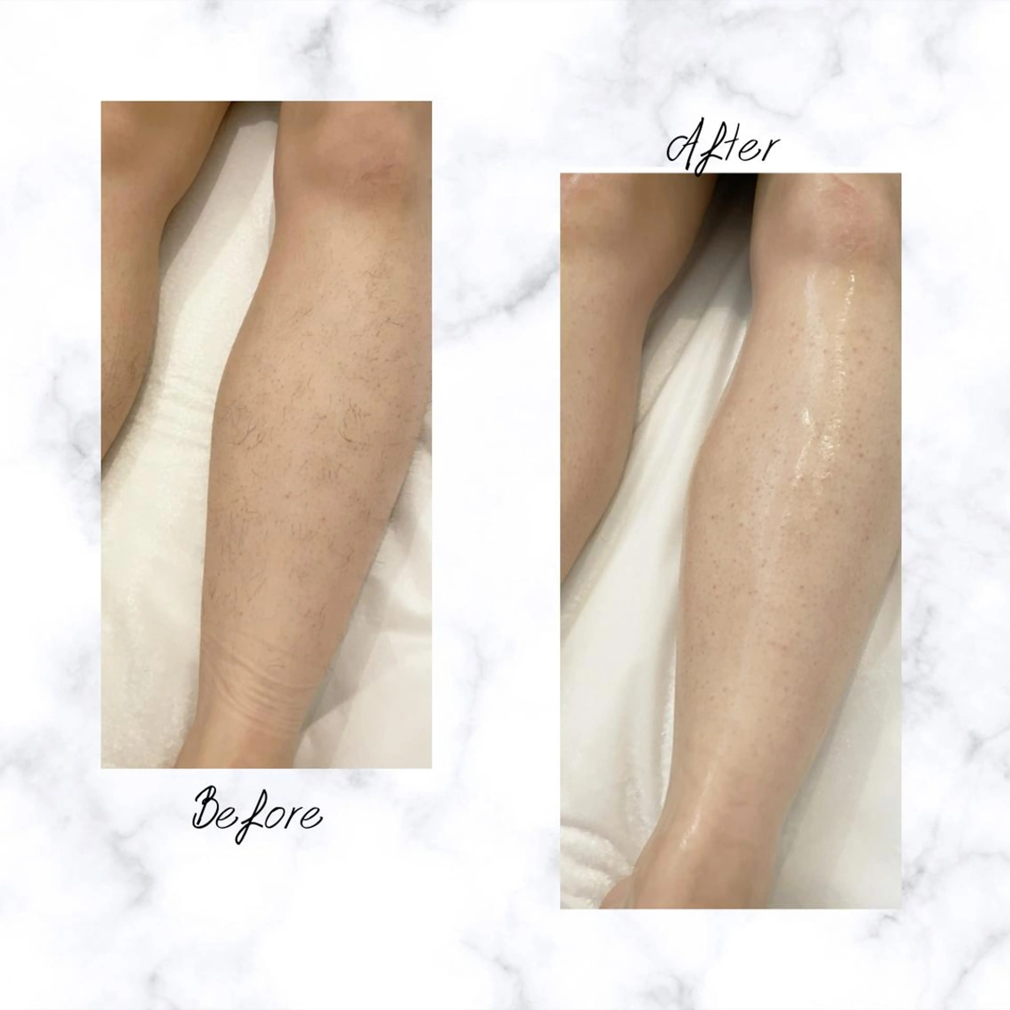 Cielo 上野店のエステ・リラクイメージ