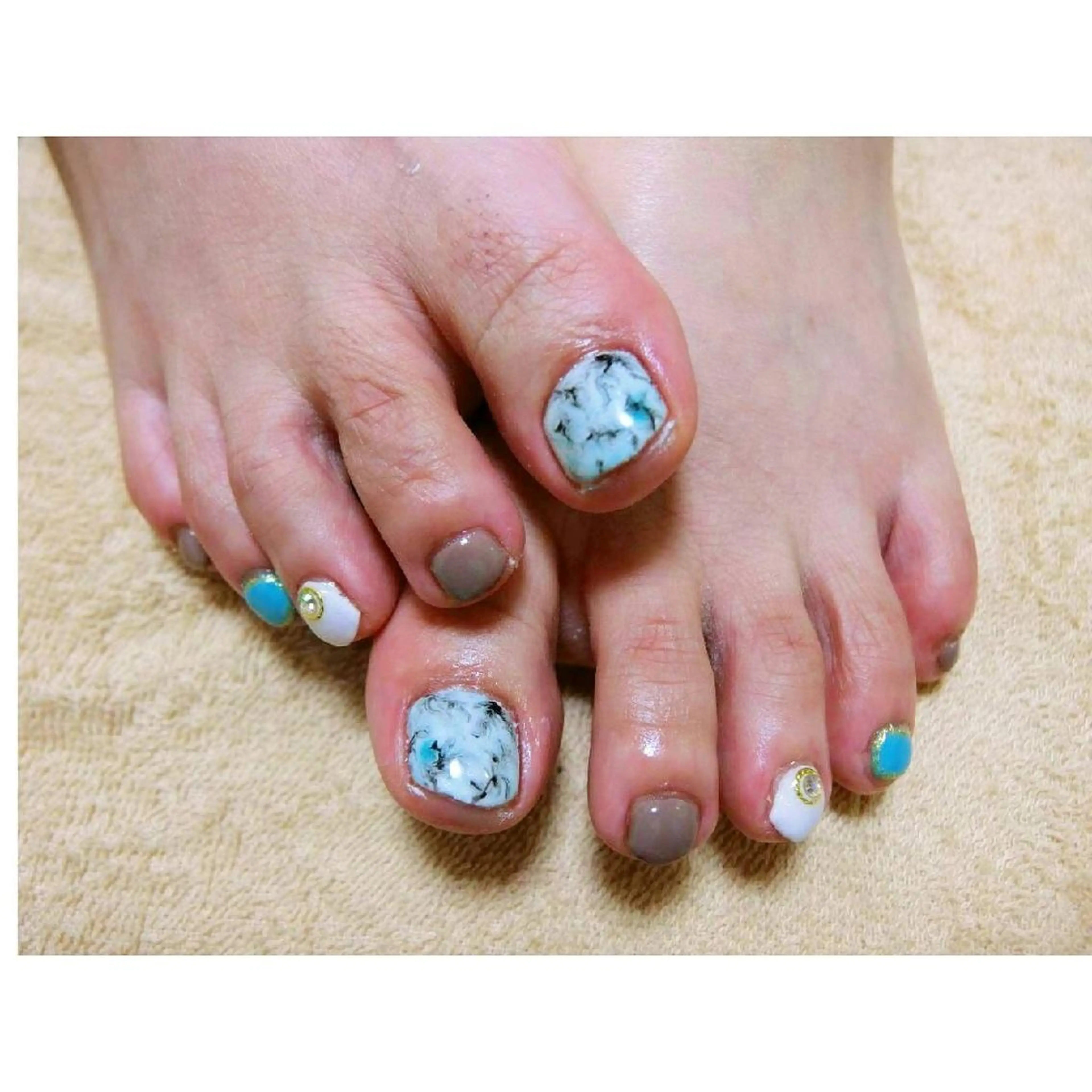 ネイル フットネイル 痛ネイル/ワンホン/ フィルイン/長さだしのネイルデザイン