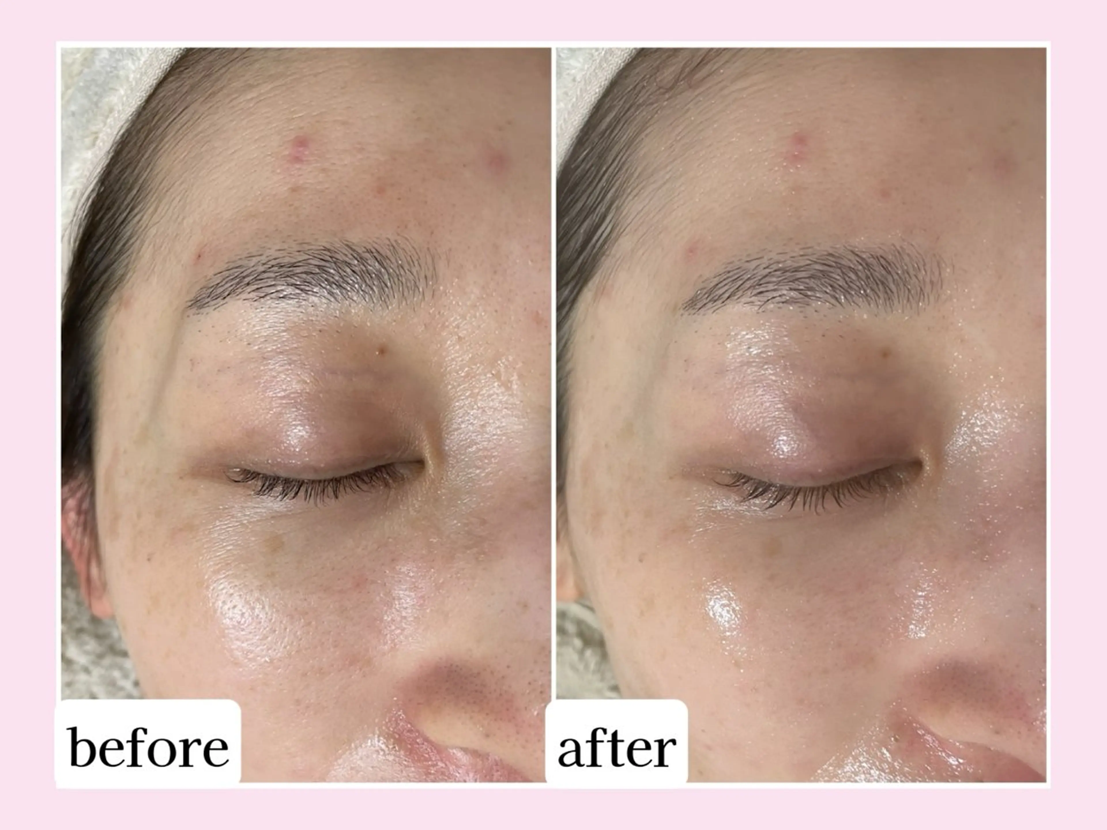 その他 Karen Private Spa所属・💜Karen PrivateSpaのエステ・リラクイメージ