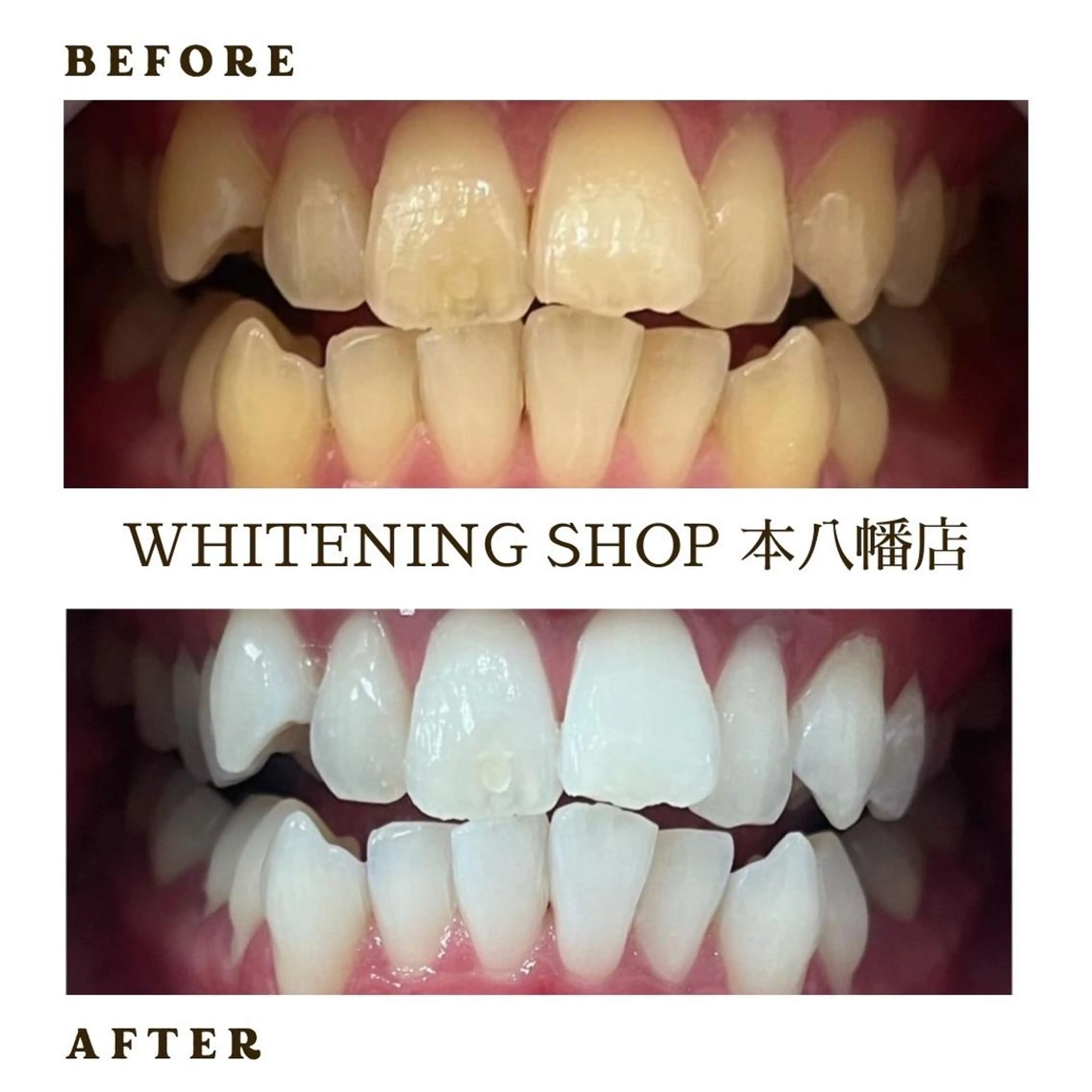 メンズ エステ リラク ホワイトニング ショップ本八幡店のエステ・リラクイメージ