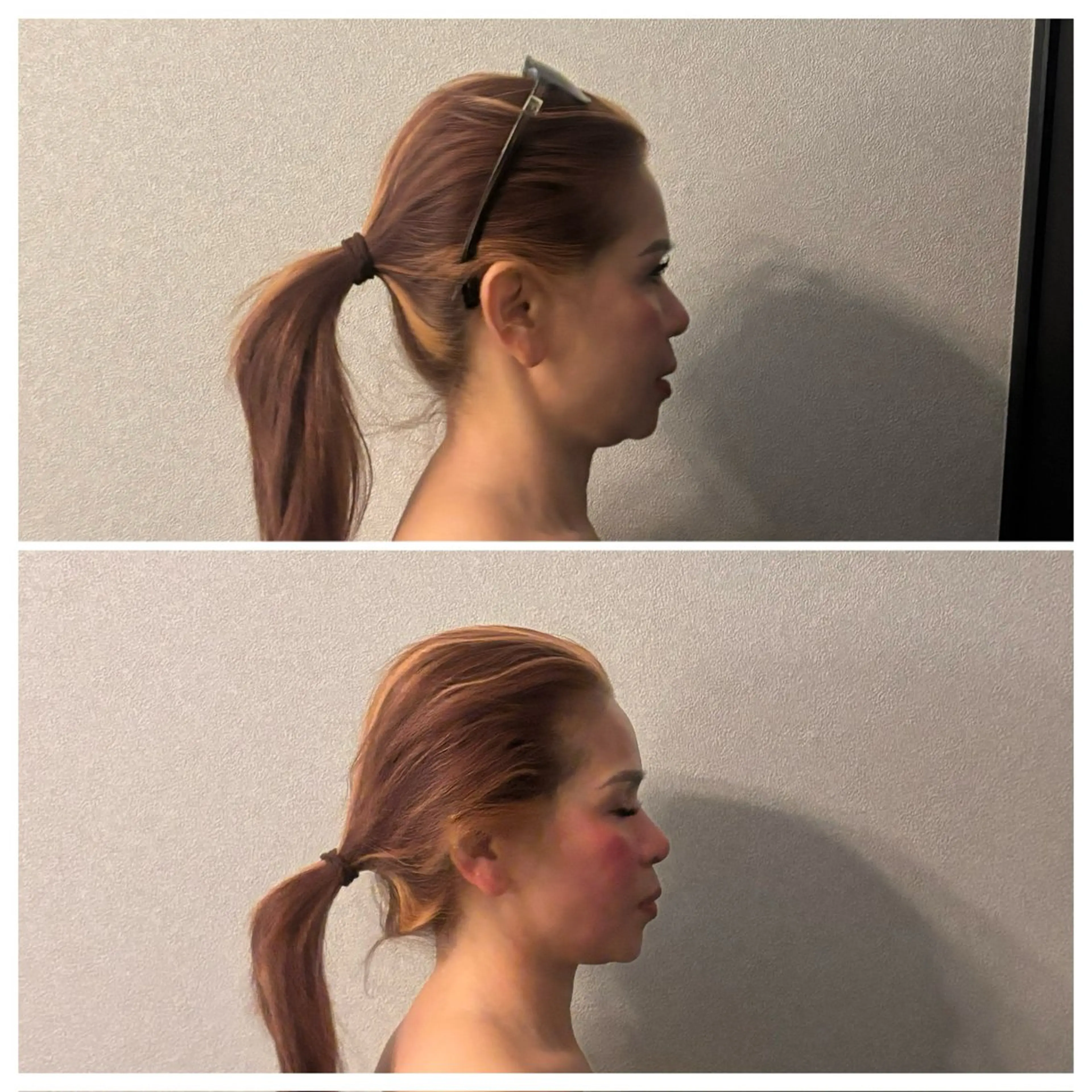 圧倒的たるみ改善 美容鍼エステのエステ・リラクイメージ