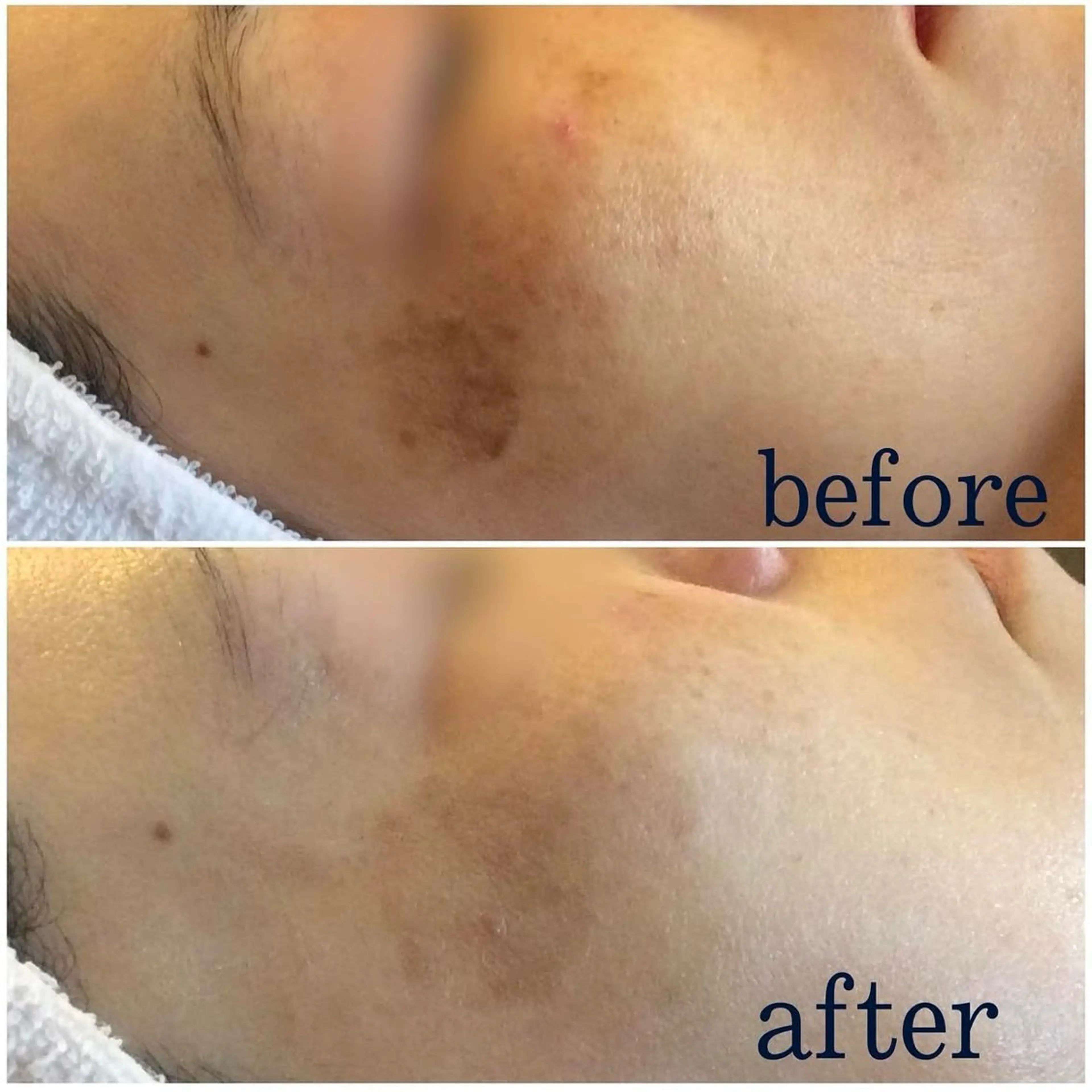 エステ Salon de Bis所属・サロン ド ビス 髙橋美月のエステ・リラクイメージ