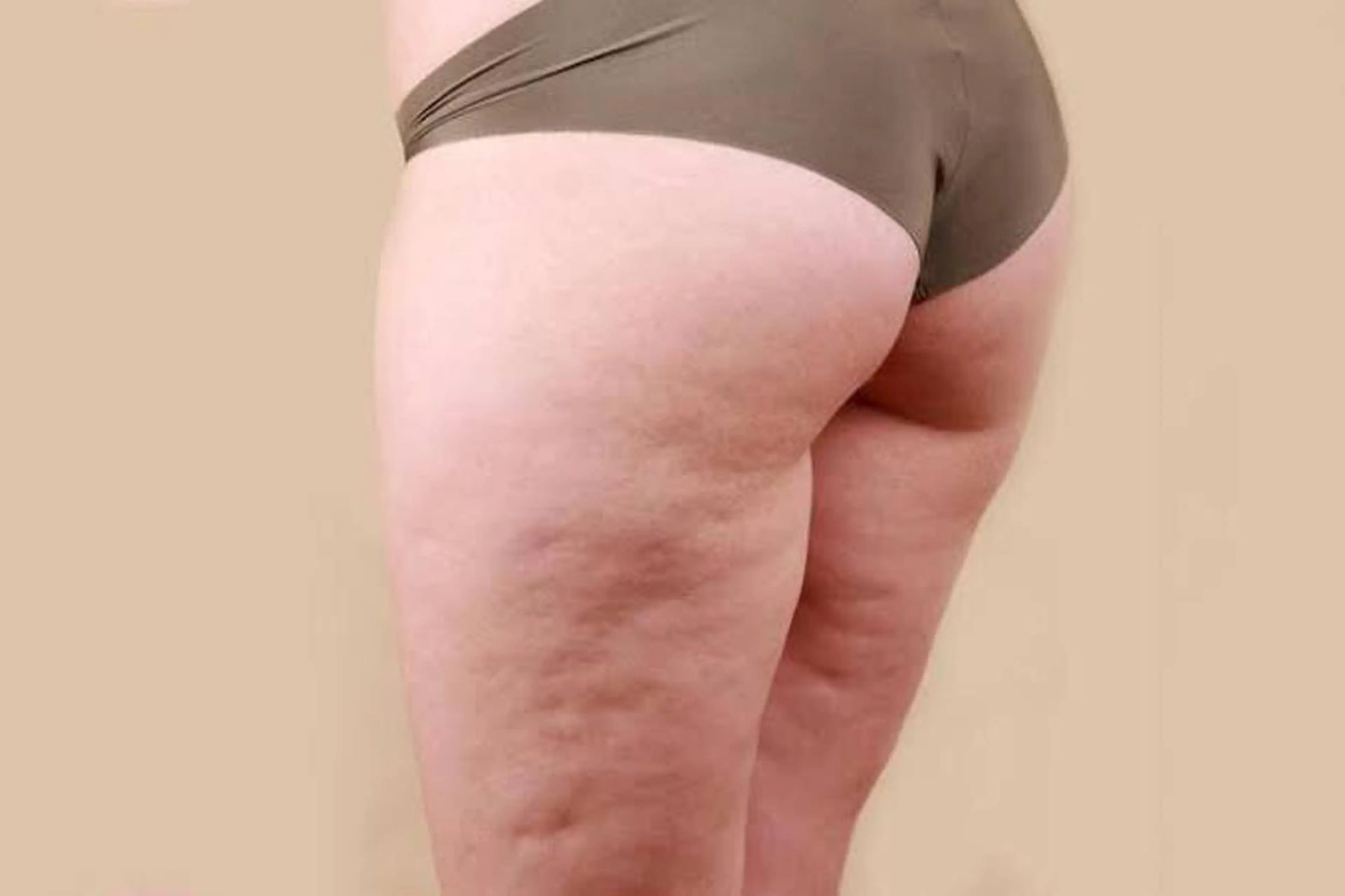 腹！尻！脚！☆まとめて鬼痩せコースの写真