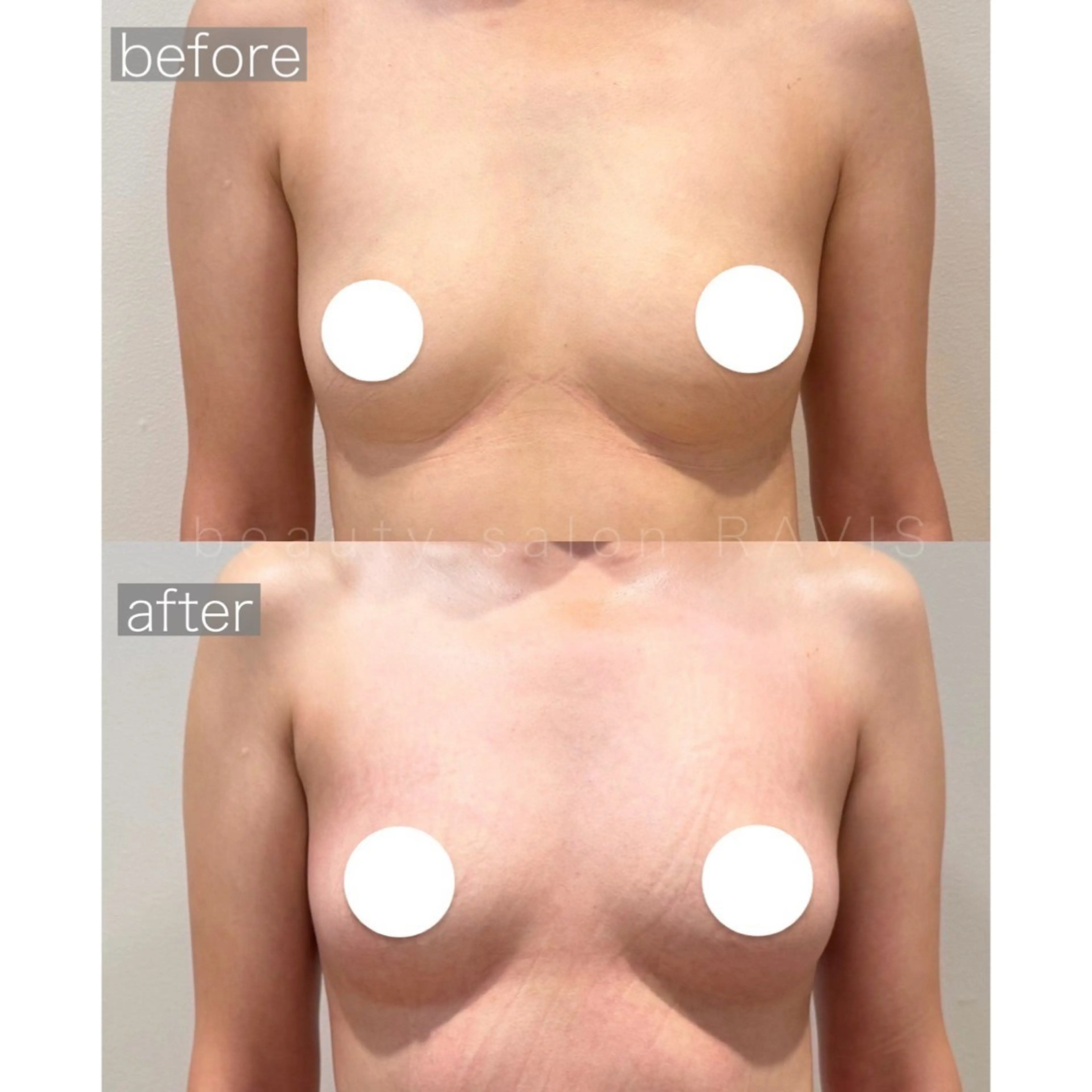 エステ beautysalon RAVIS所属・東大阪/韓国肌管理/ 痩身バスト専門店のエステ・リラクイメージ