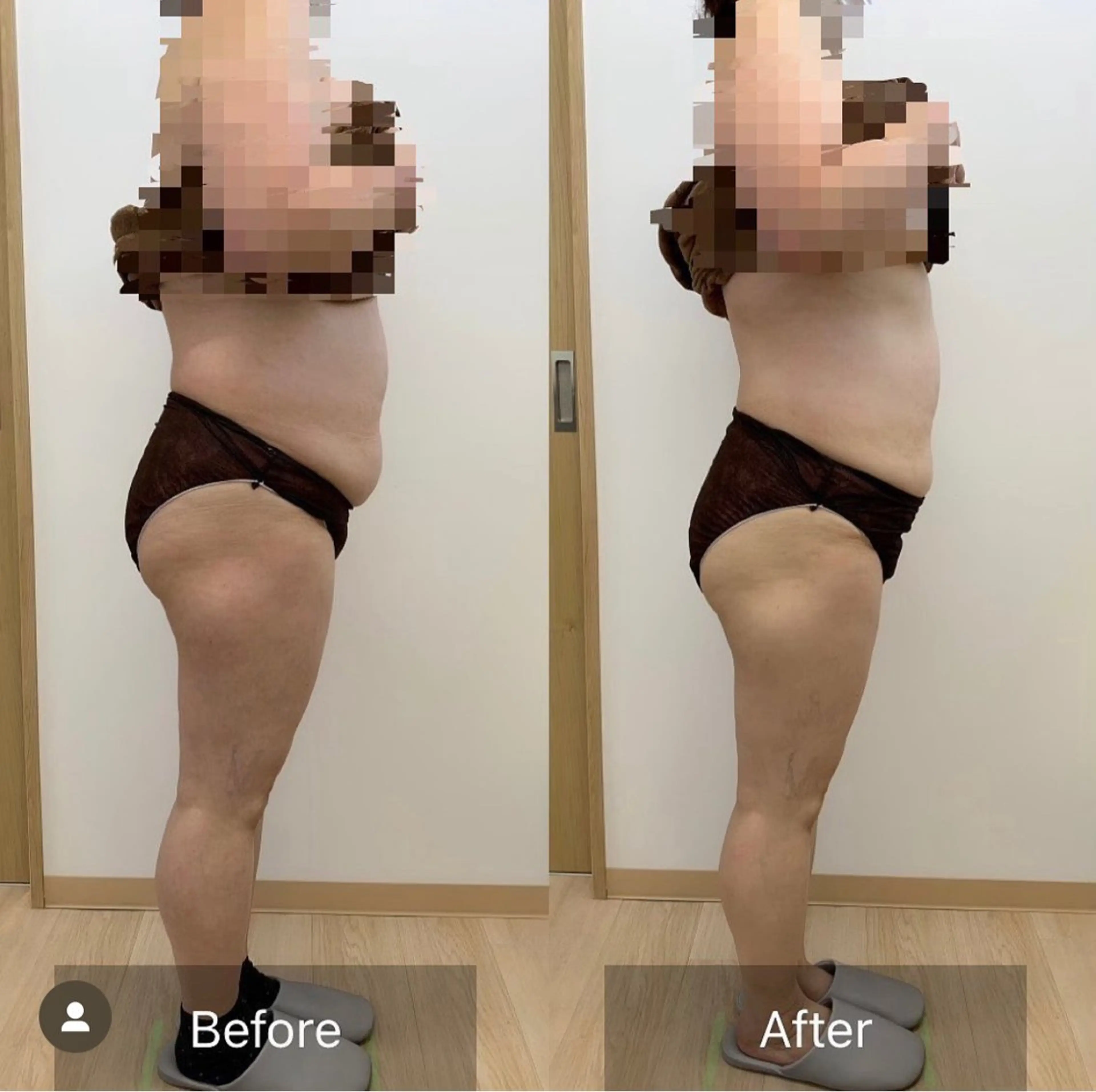 エステ LUCEVIA ルセヴィアのその他イメージ