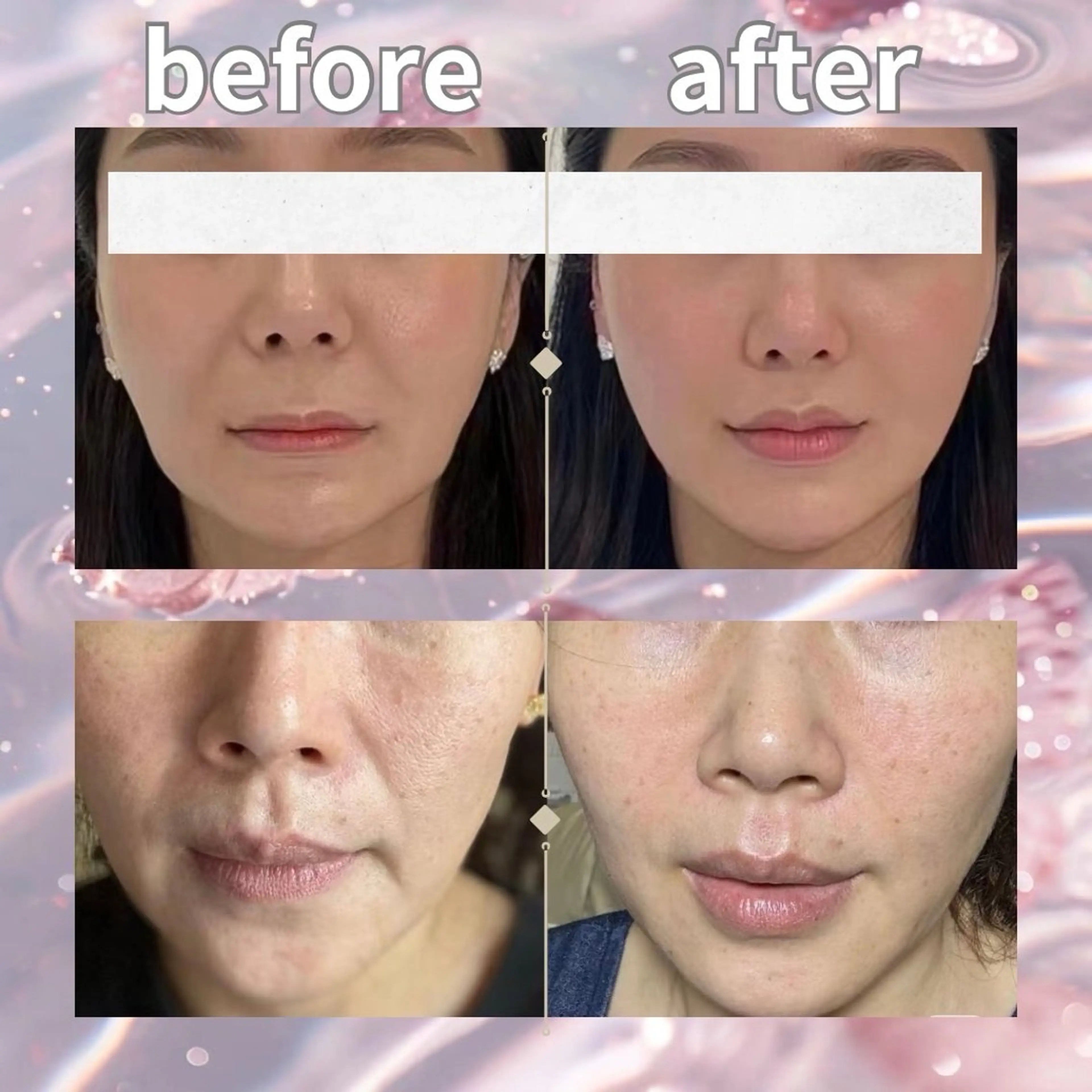 ネイル エステ aliaハイフ&水光ジェットサロン所属・aliaハーブ水光店 エステティシャン募集のエステ・リラクイメージ