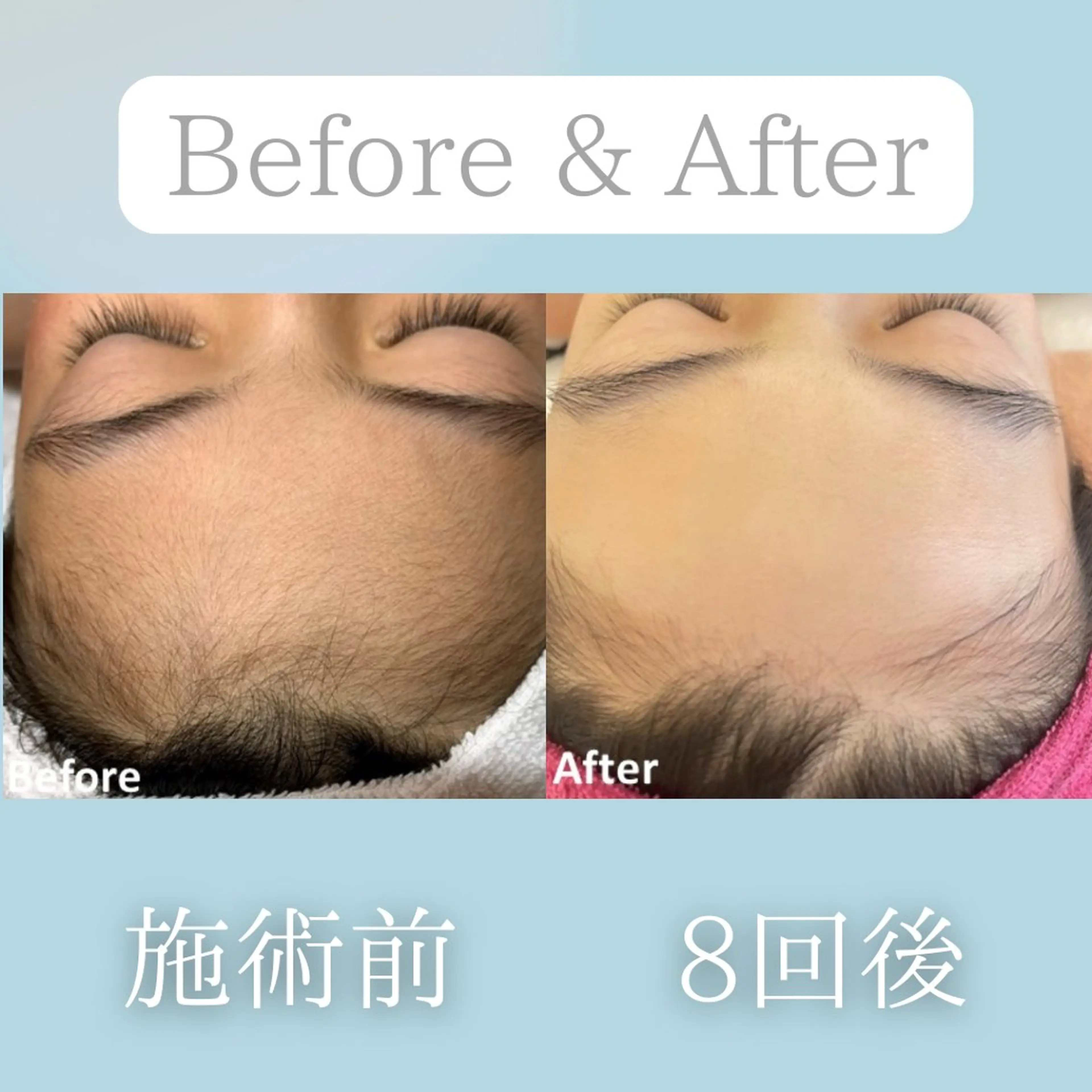 美肌脱毛&毛穴専門 Nico🐰ྀི♡のエステ・リラクイメージ