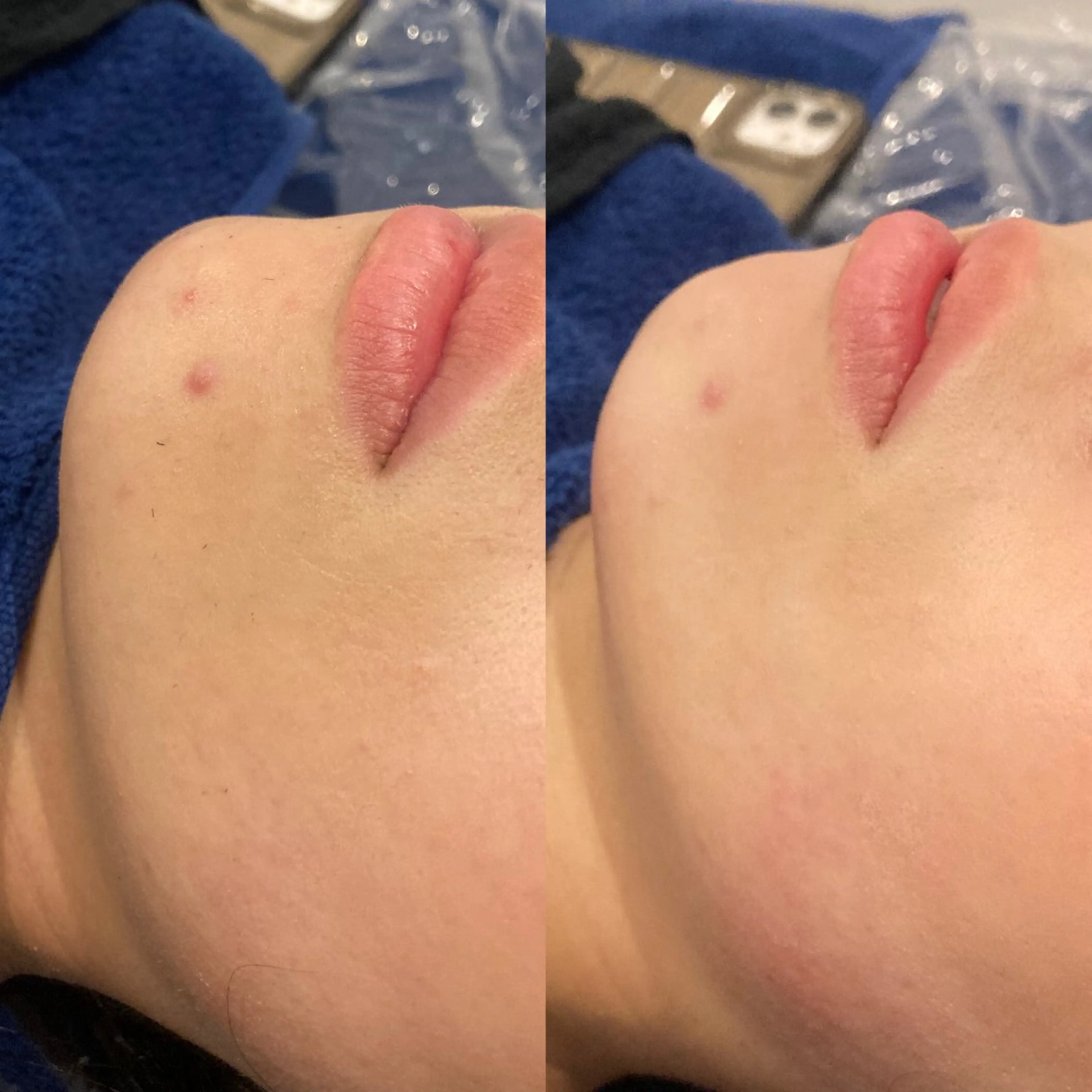 エステ リラク NANI OAFU所属・NANIOAFU [なんば店］のその他イメージ