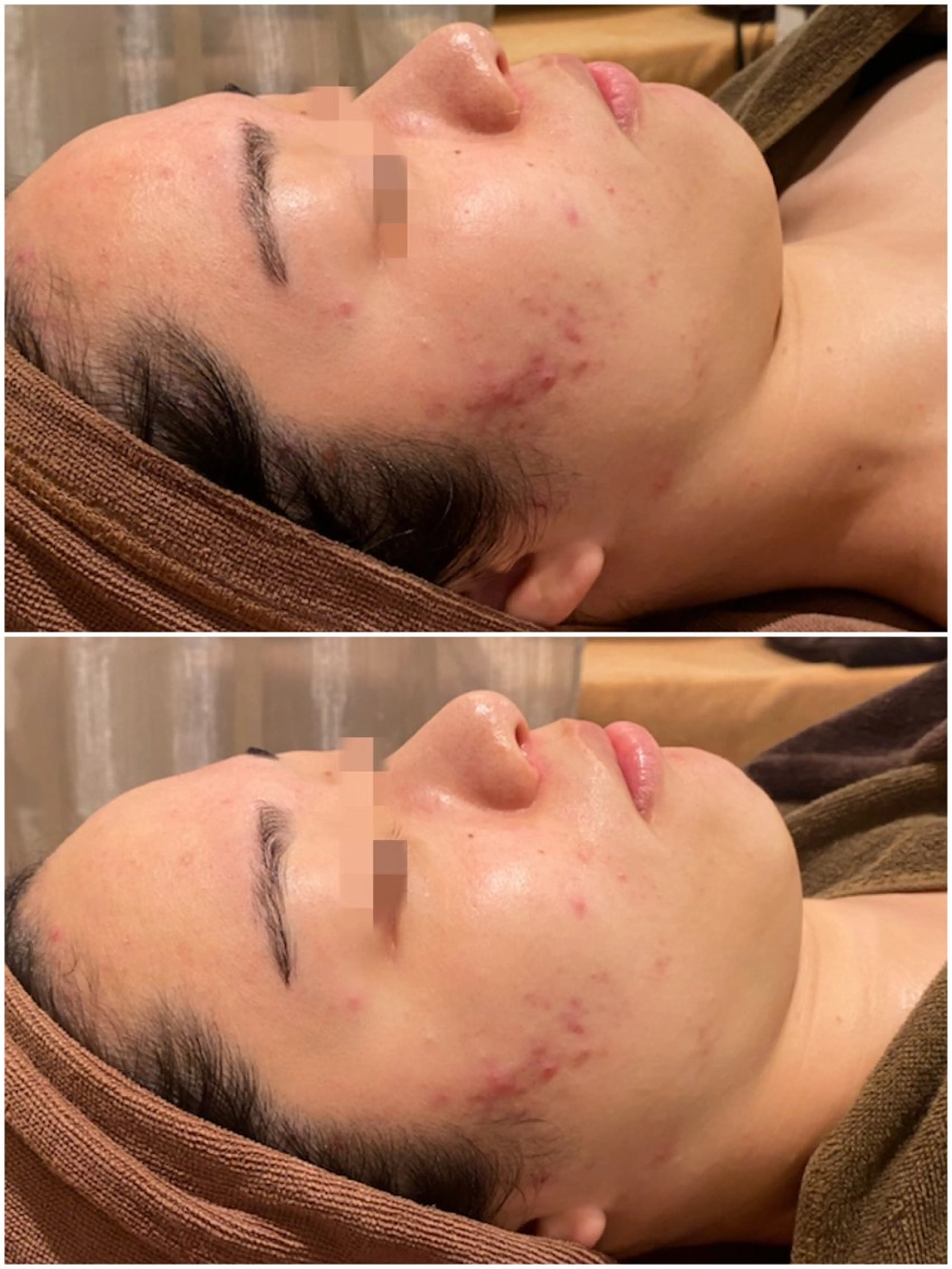 エステ 美u•p 鶴ヶ峰店のマツエク・マツパデザイン