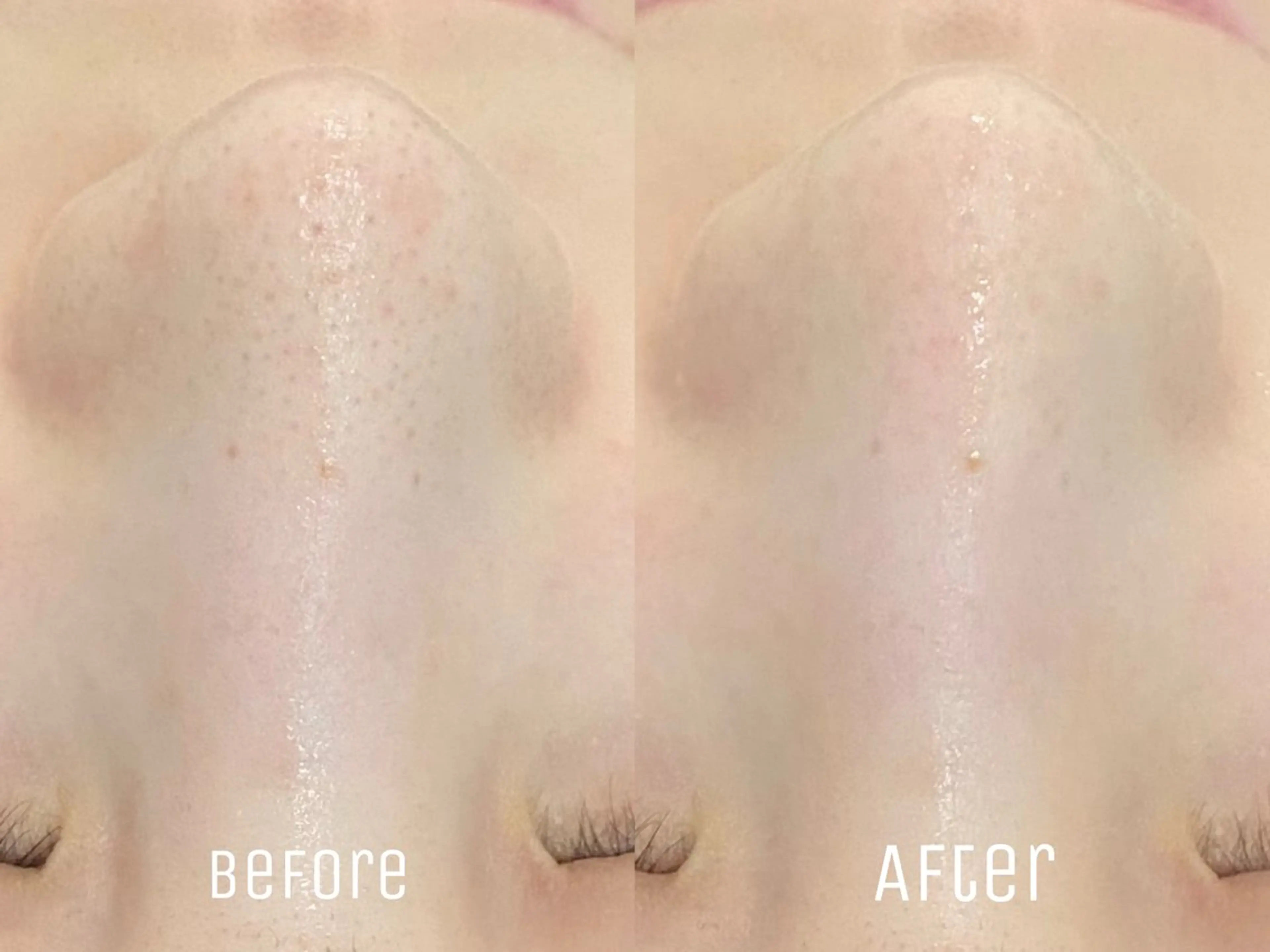 エステ ニキビ・毛穴・肌荒れ &me 西宮北口店のその他イメージ