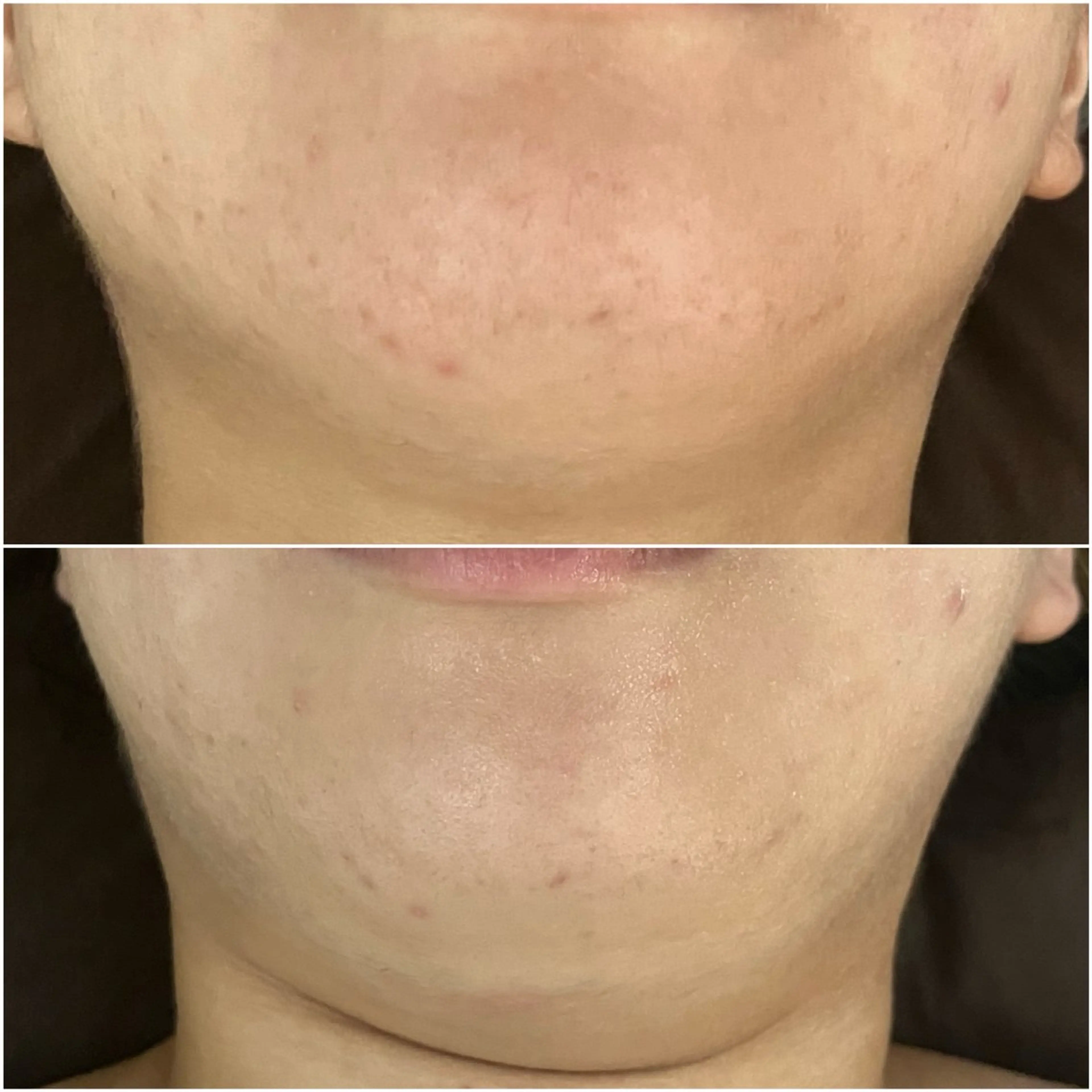 エステ ニキビケア Moto rihi【モトリヒ】のエステ・リラクイメージ