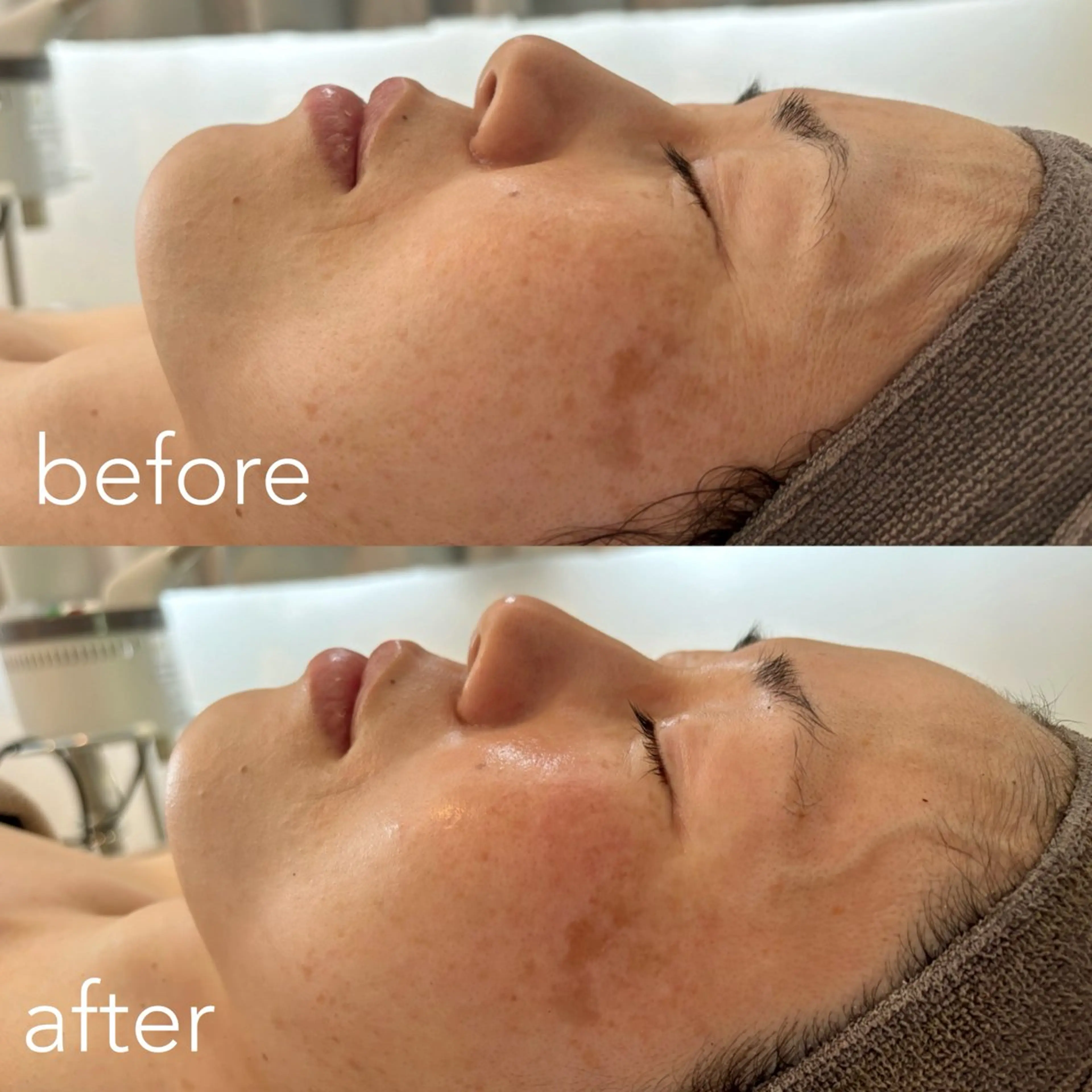 エステティックサロン Liente(リアンテ）所属・Hashimoto .のエステ・リラクイメージ