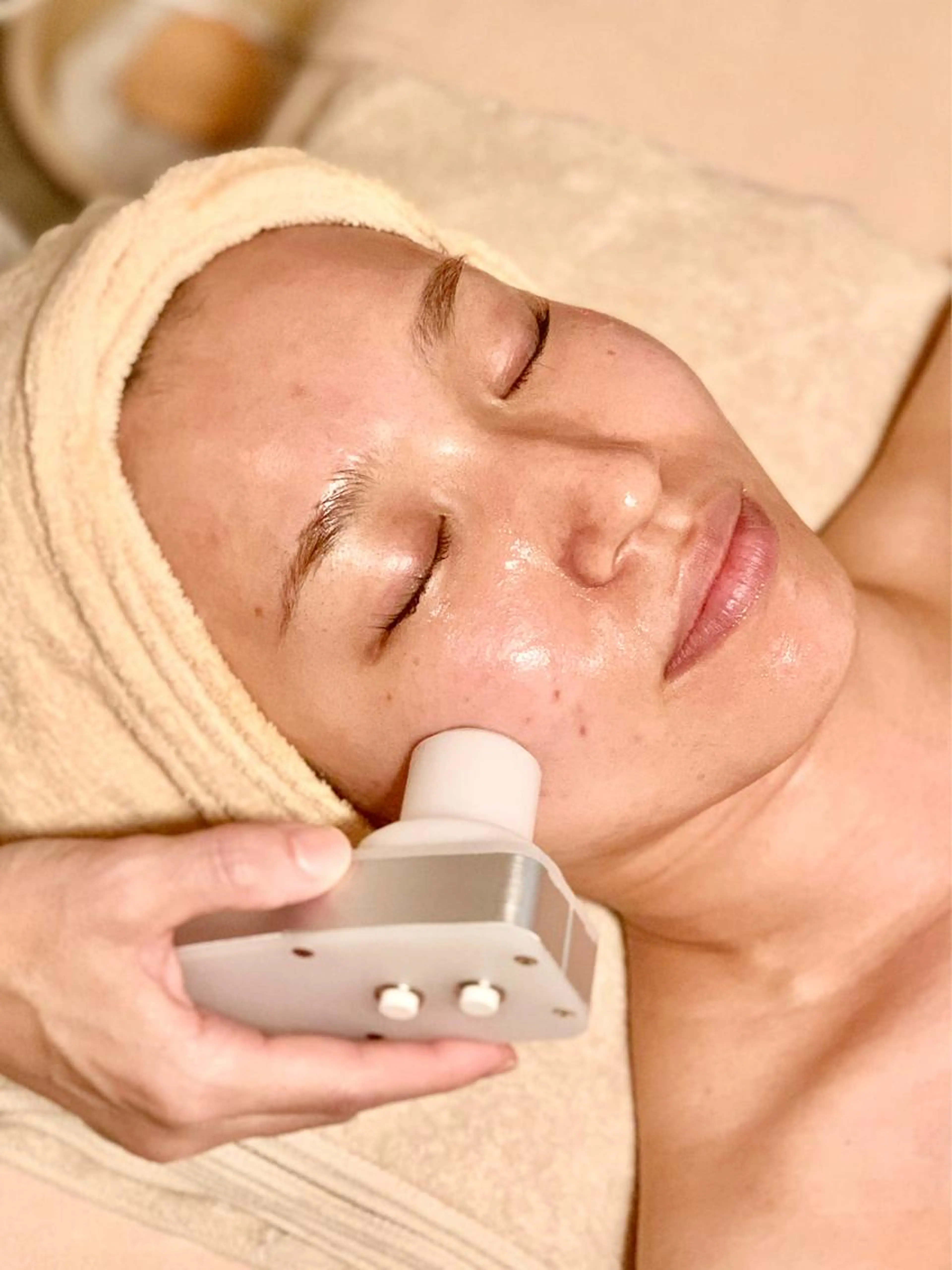 しみ改善、美肌コース (しみ・しわが気になる方)VC20をエレクトロポレーションで導入❗️メラニンの生成を抑制の写真