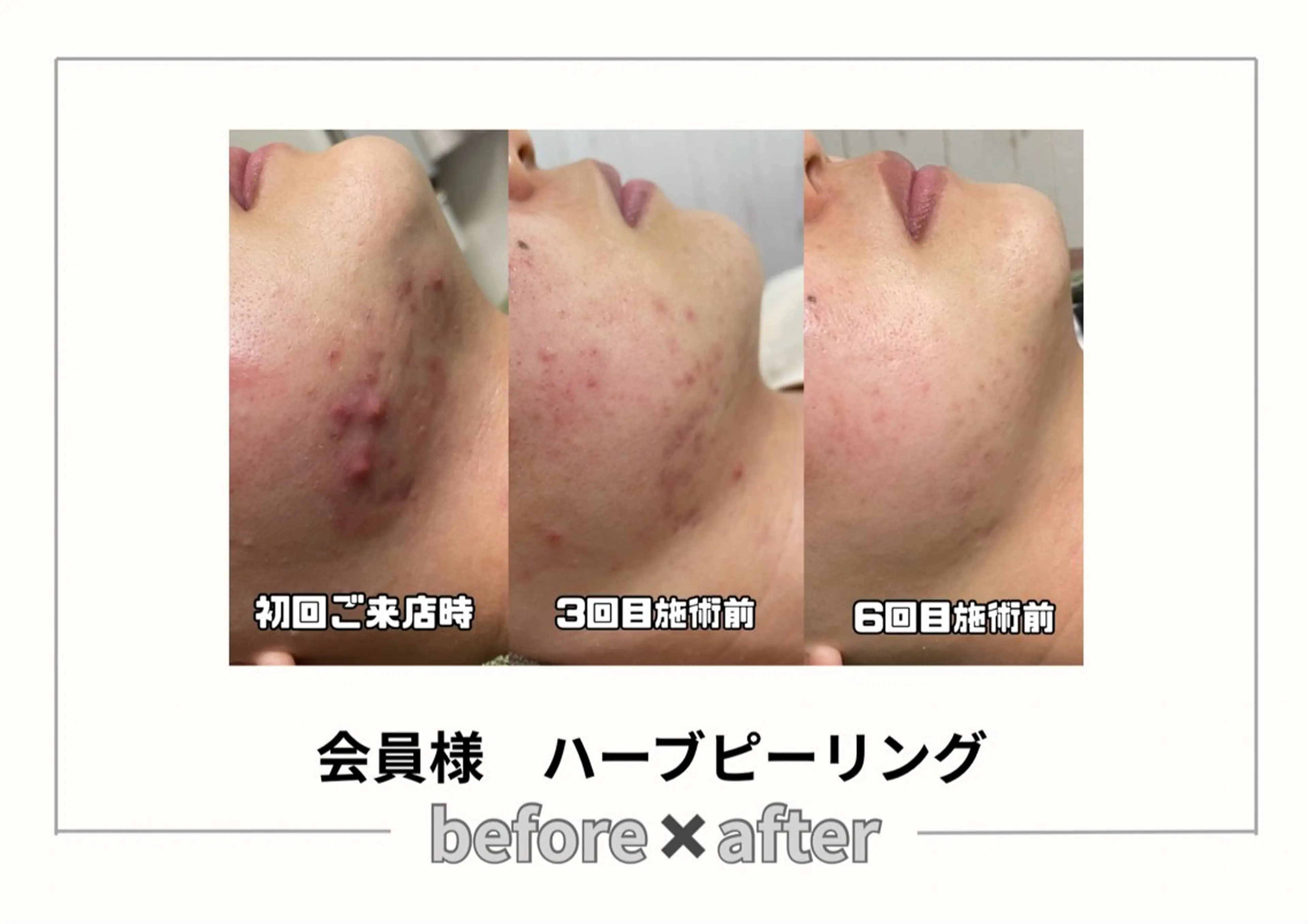 エステ みんなの脱毛ツルリン ☀️船橋店☀️のエステ・リラクイメージ