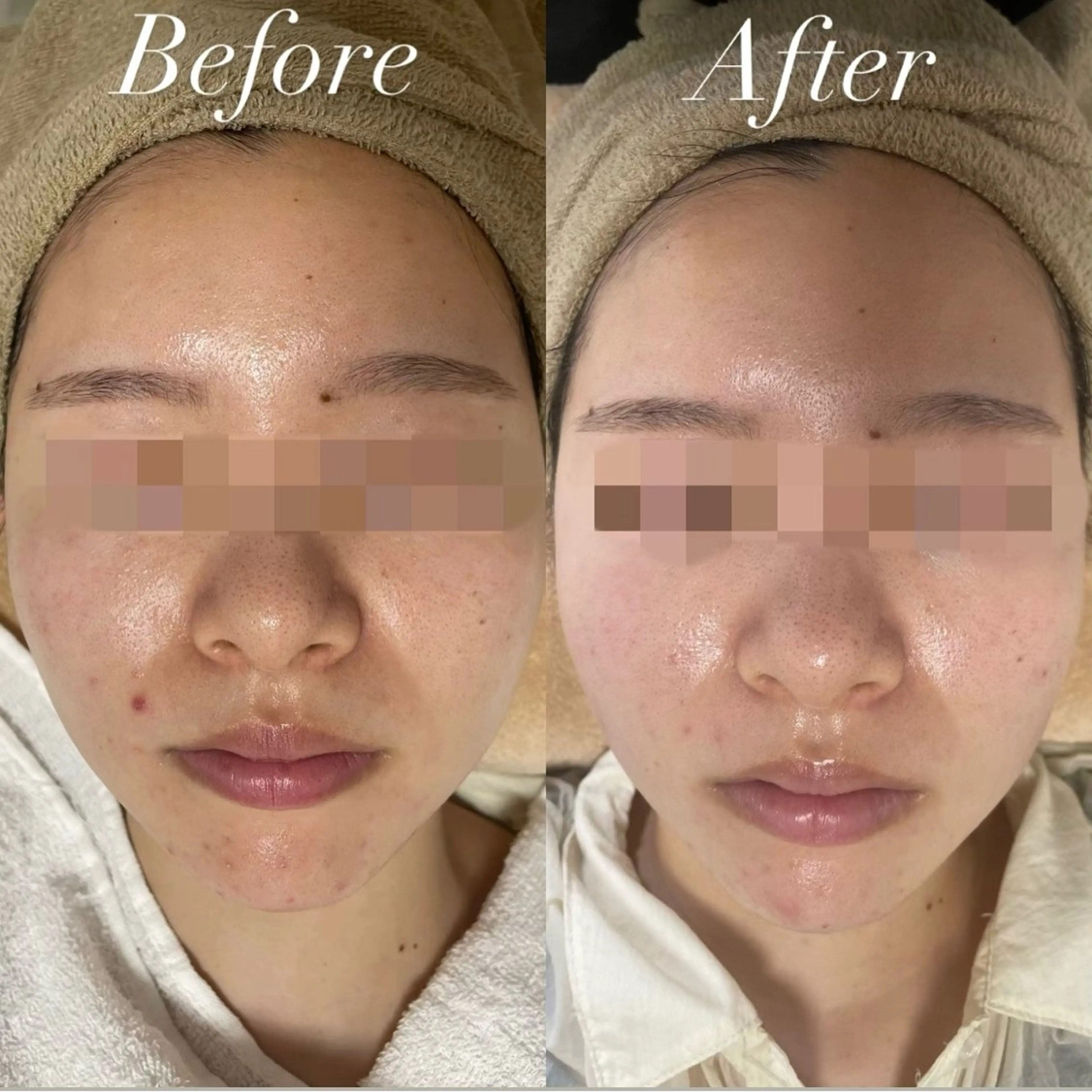 エステ プライベートサロン Belle（ベル）のエステ・リラクイメージ