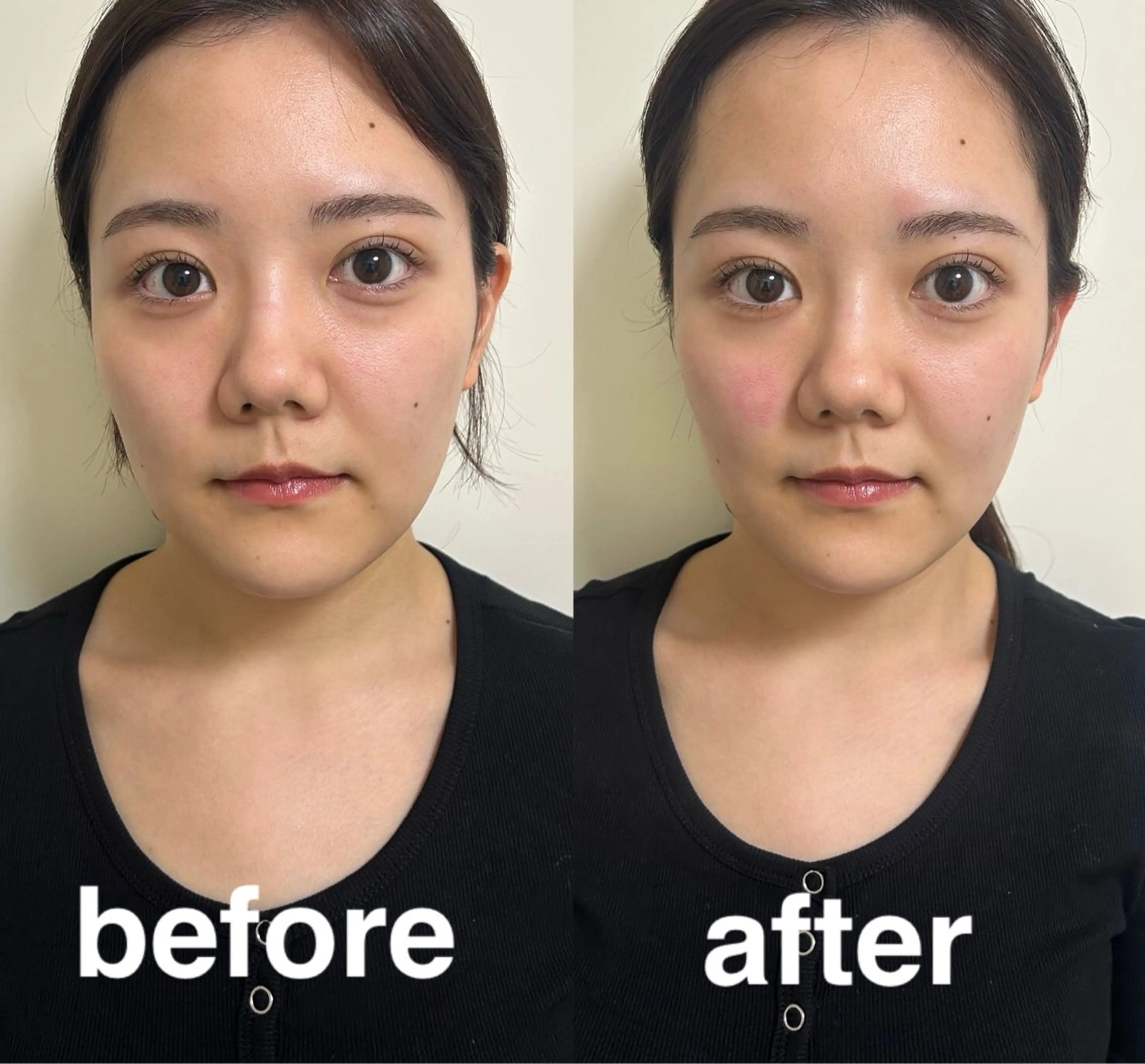 美容鍼灸サロン mahoroba院長のエステ・リラクイメージ