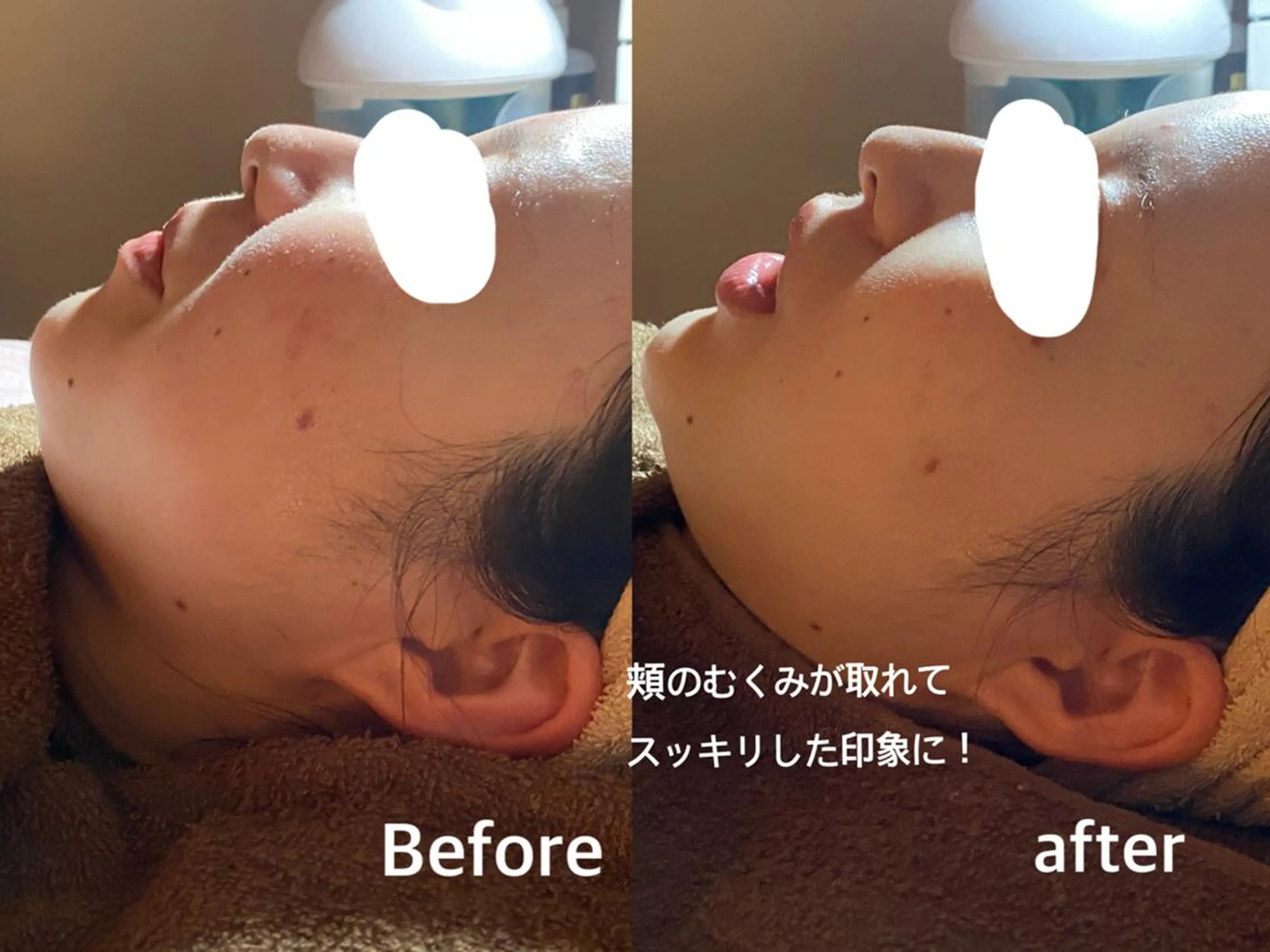 NICOLAUGH/ 村松【小顔.ボディ】のエステ・リラクイメージ