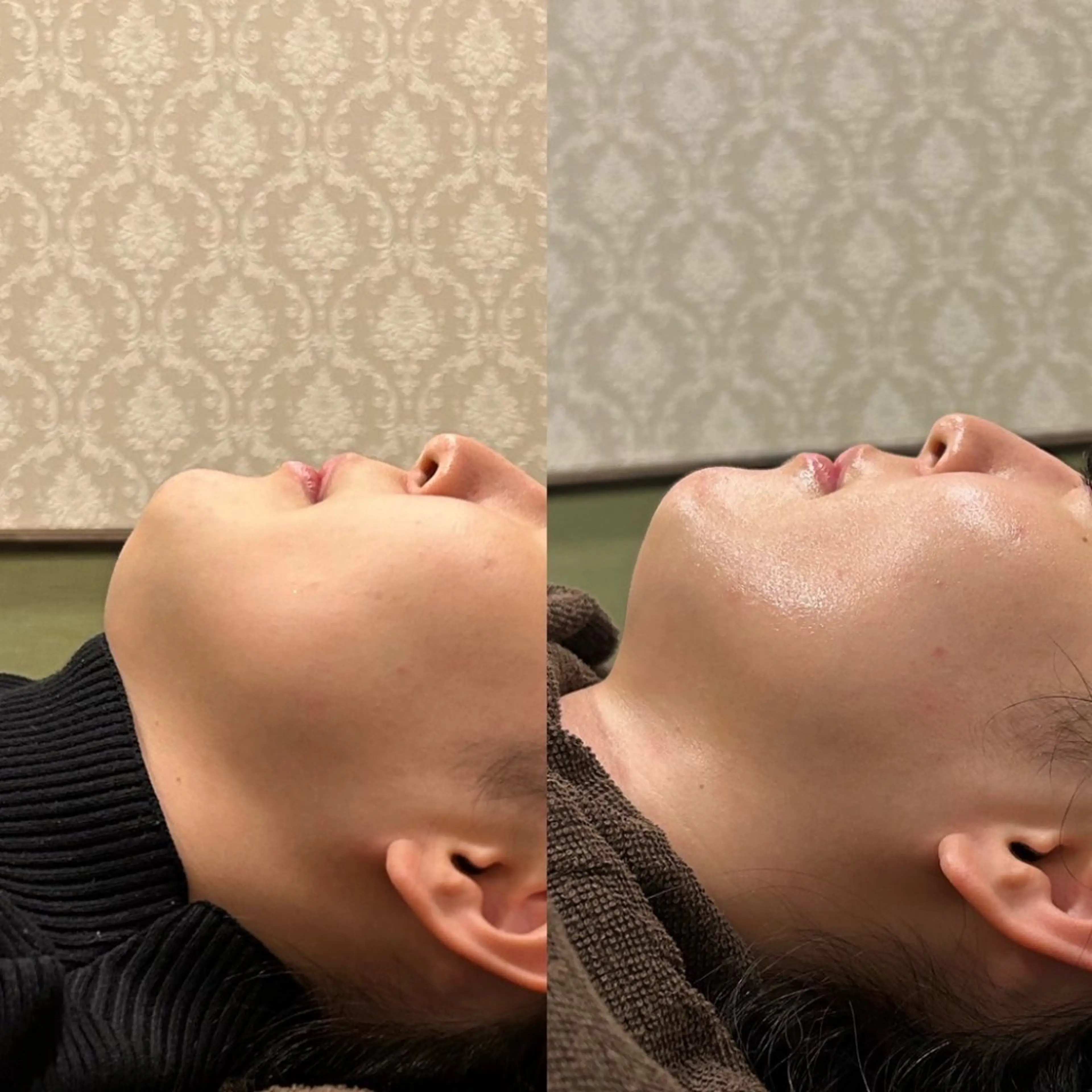 # fu♡のエステ・リラクイメージ