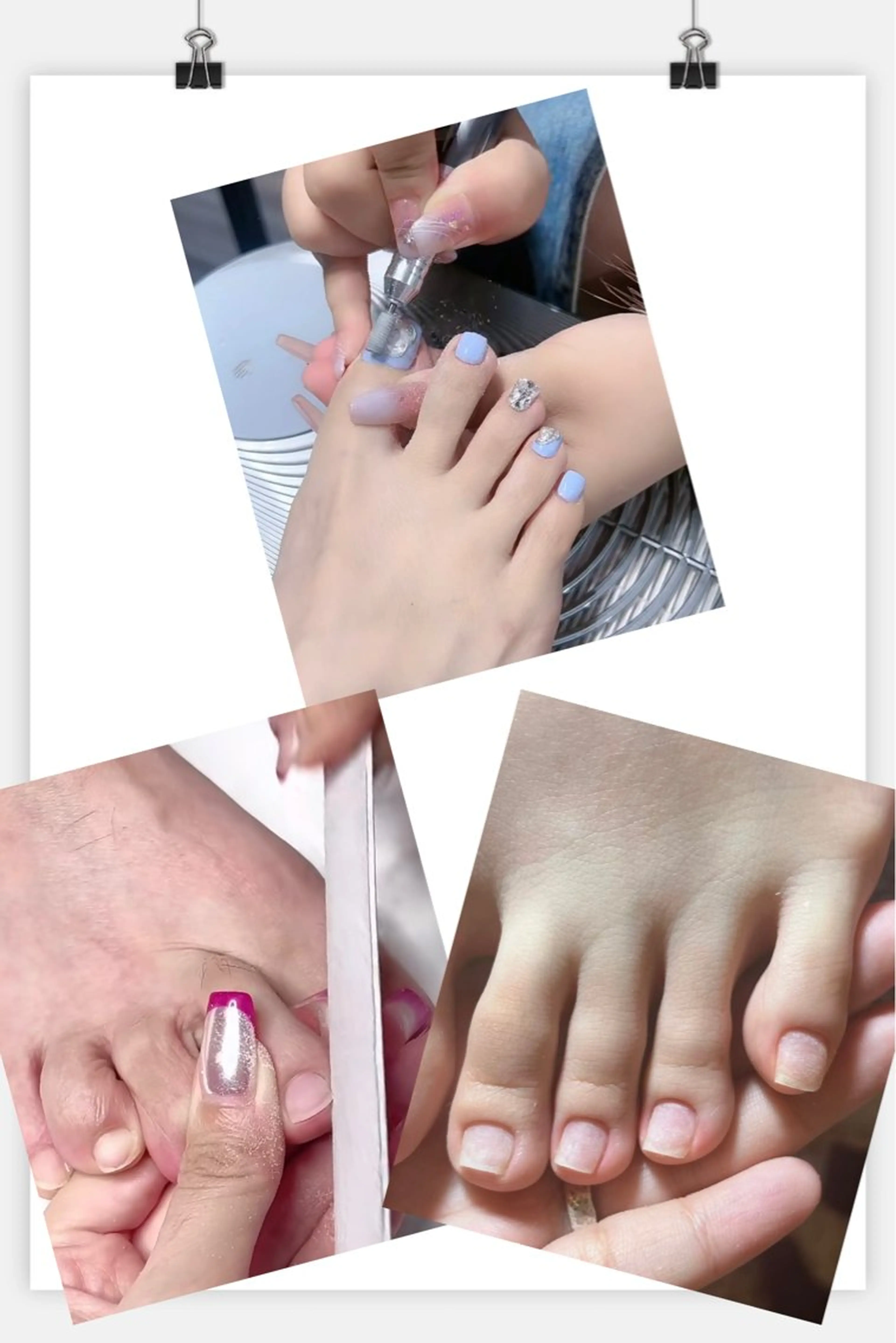 他店表面整えのみの写真