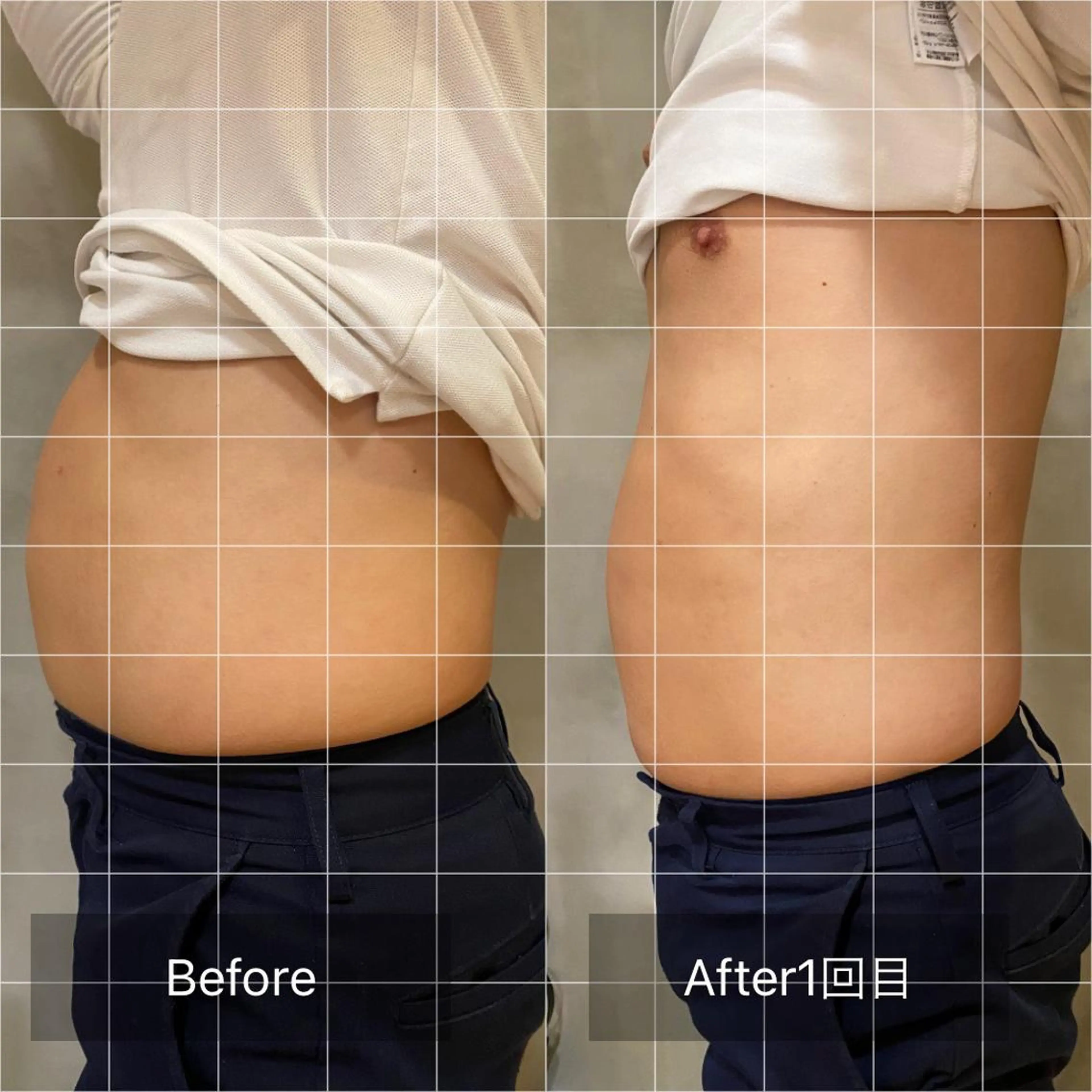 メンズ その他 RemoreBeauty所属・Nakano Kazunariのエステ・リラクイメージ