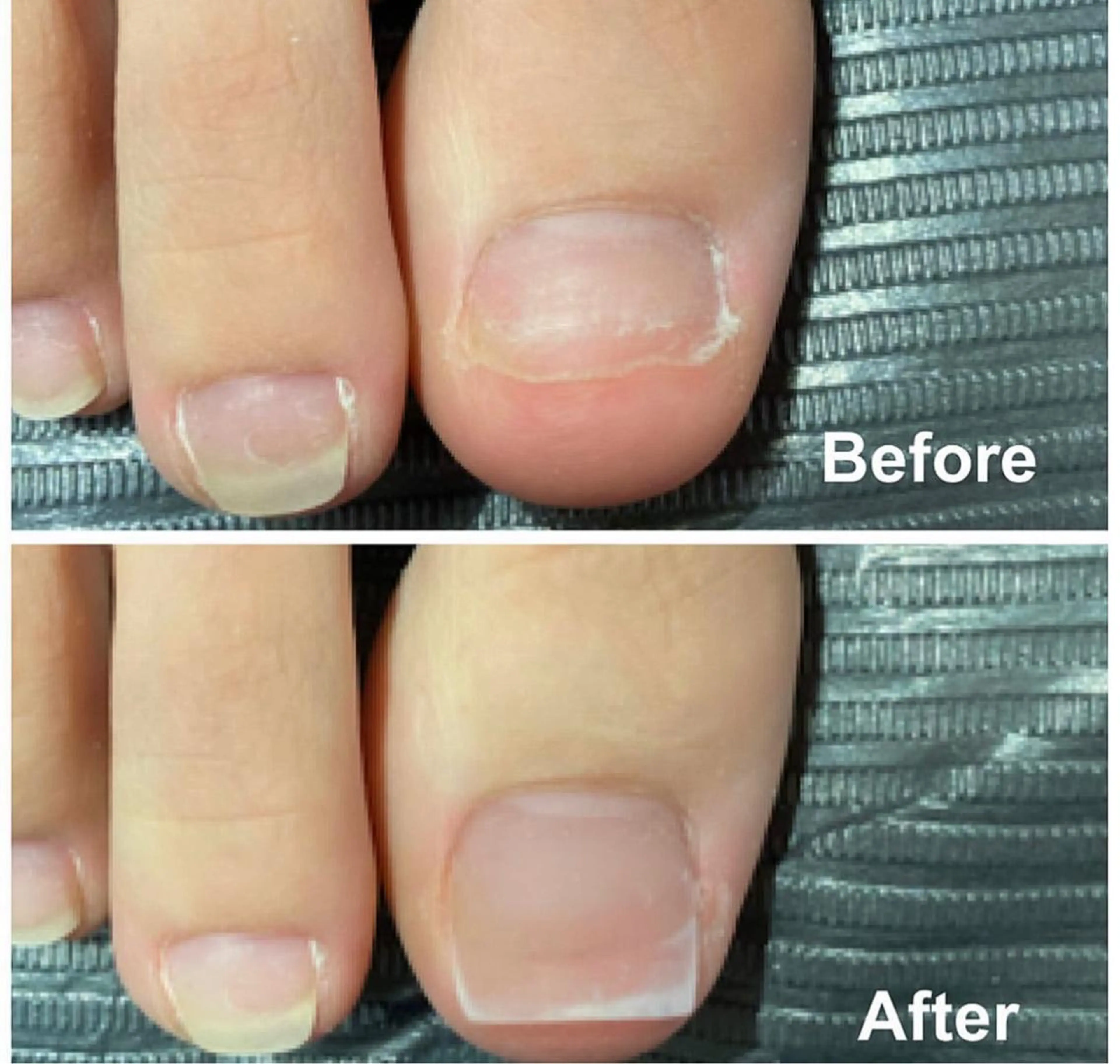 ネイル 長さ出し フットネイル She   Nail所属・ISA_ BELLAのネイルデザイン