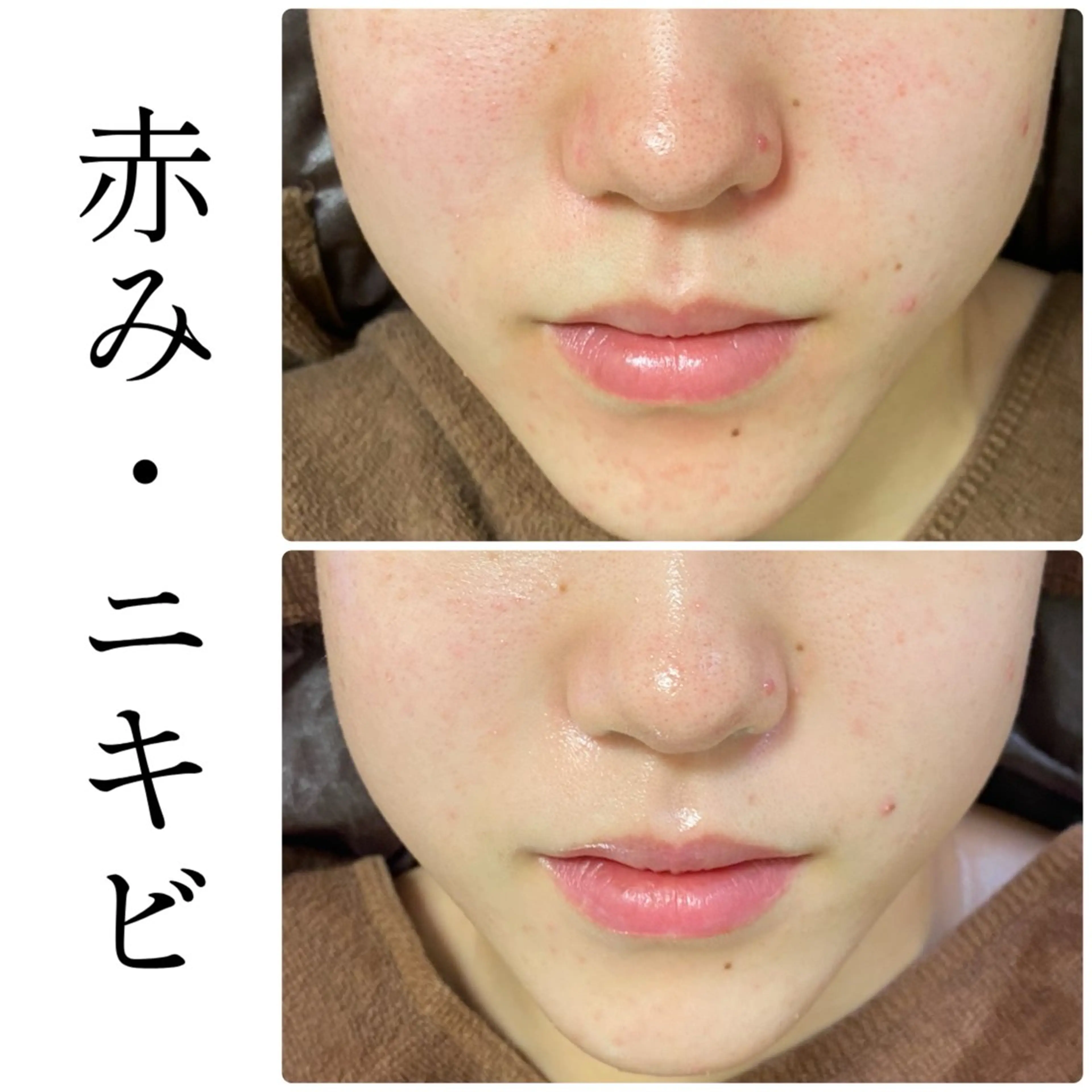 ハーブピーリング専門 BIOEL横浜のエステ・リラクイメージ