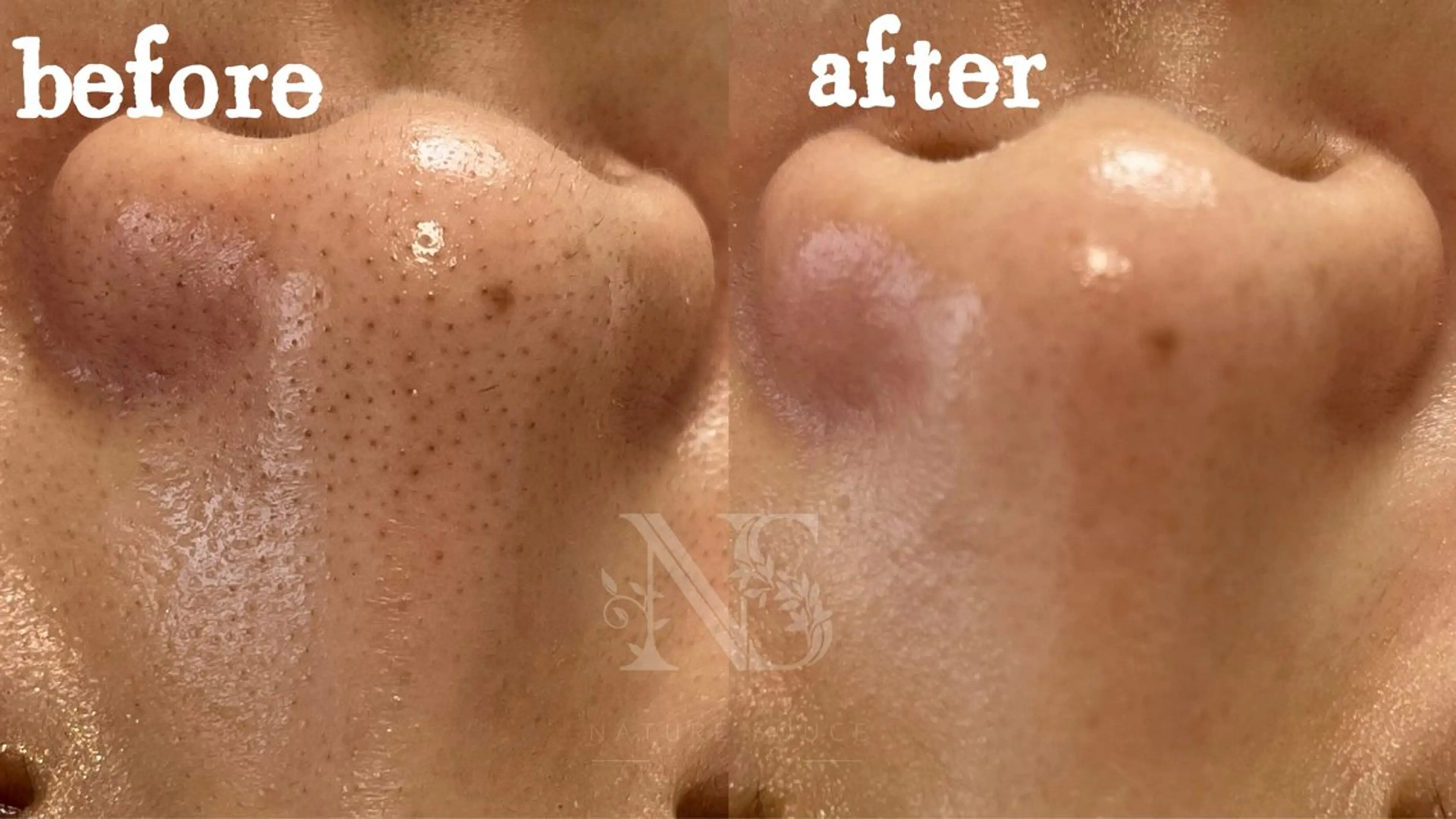 Nature Souce毛穴専門店のその他イメージ