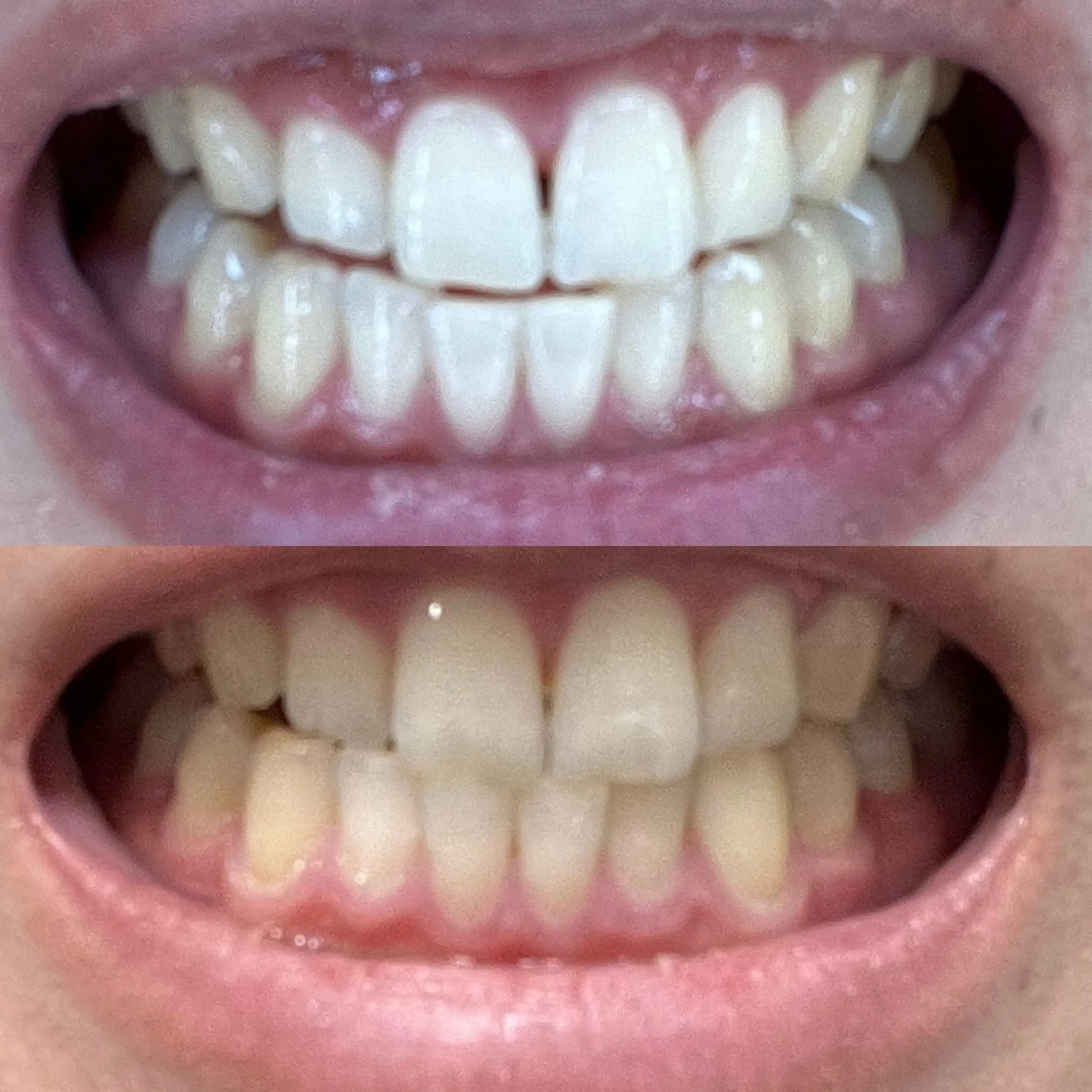 その他 エクシアホワイトニング草津店所属・nanami -ホワイトニングのその他イメージ