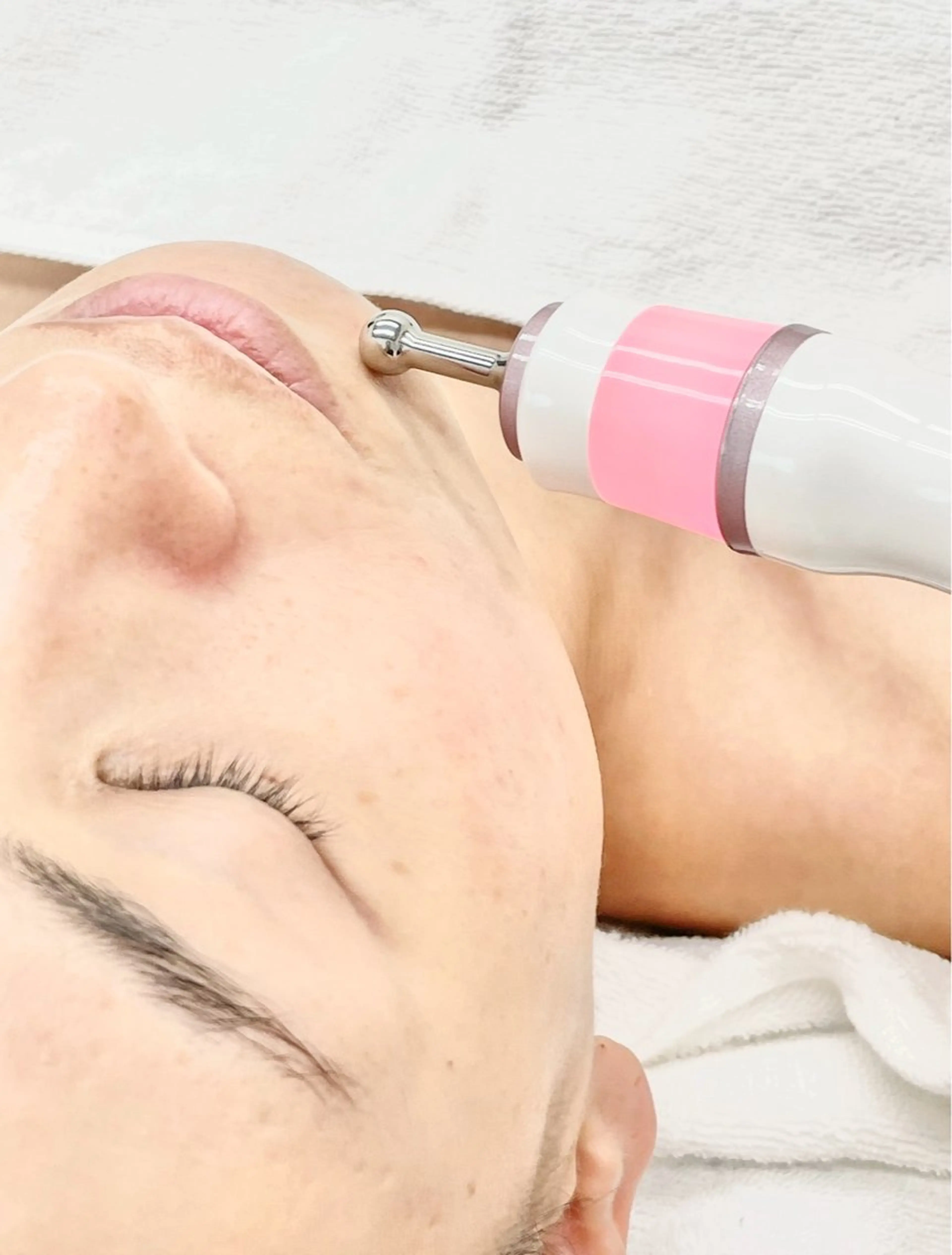 🌟メニューに迷ったらコレ!!!🌟究極のエイジングケア!プラズマフェイシャルケア!!の写真