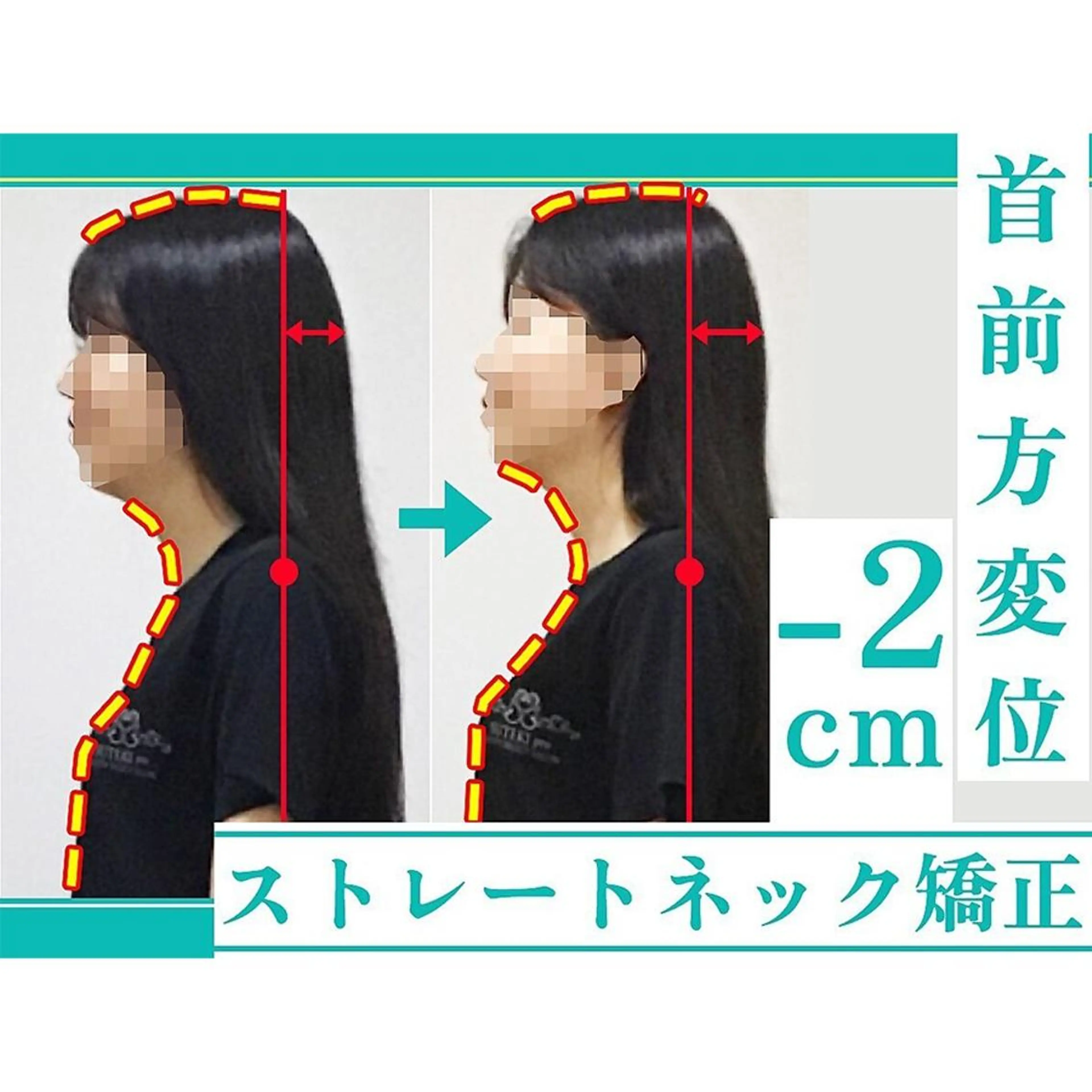 姿勢・骨盤/小顔矯正 痩身ダイエット 横田のエステ・リラクイメージ