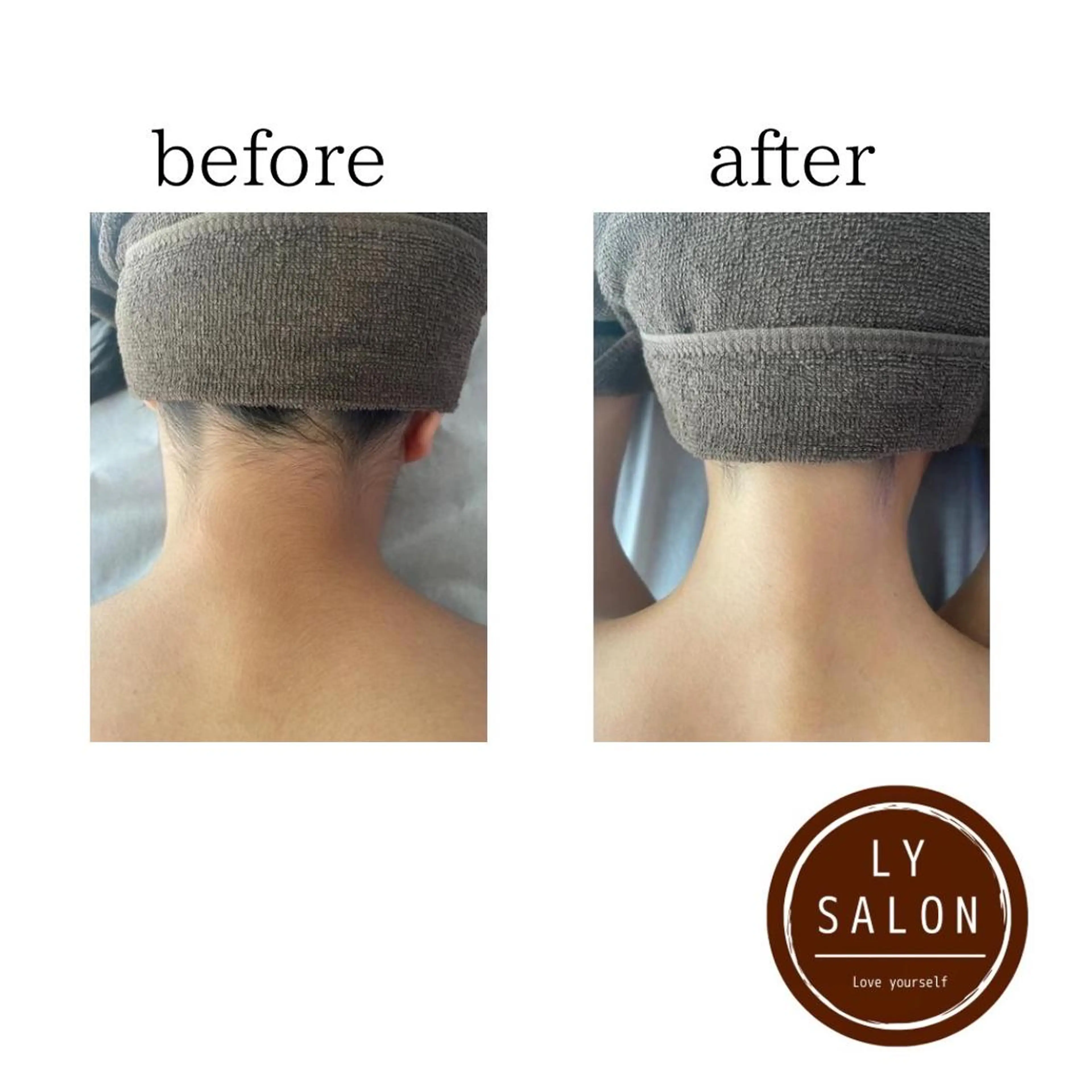 キッズ 脱毛 LY SALON所属・LY　SALON♡ トータルビューティーのエステ・リラクイメージ