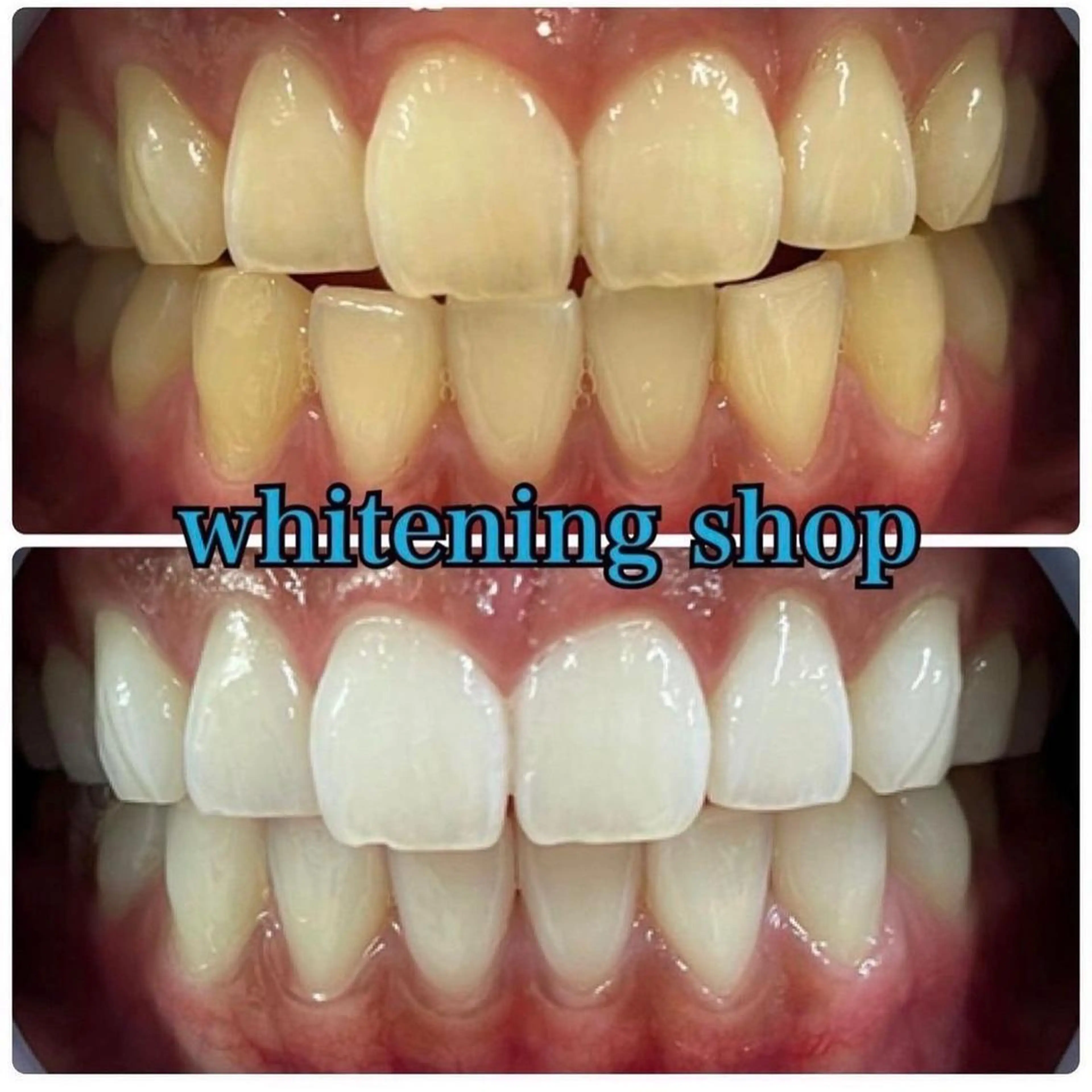 ホワイトニング ショップ吉祥寺店のエステ・リラクイメージ