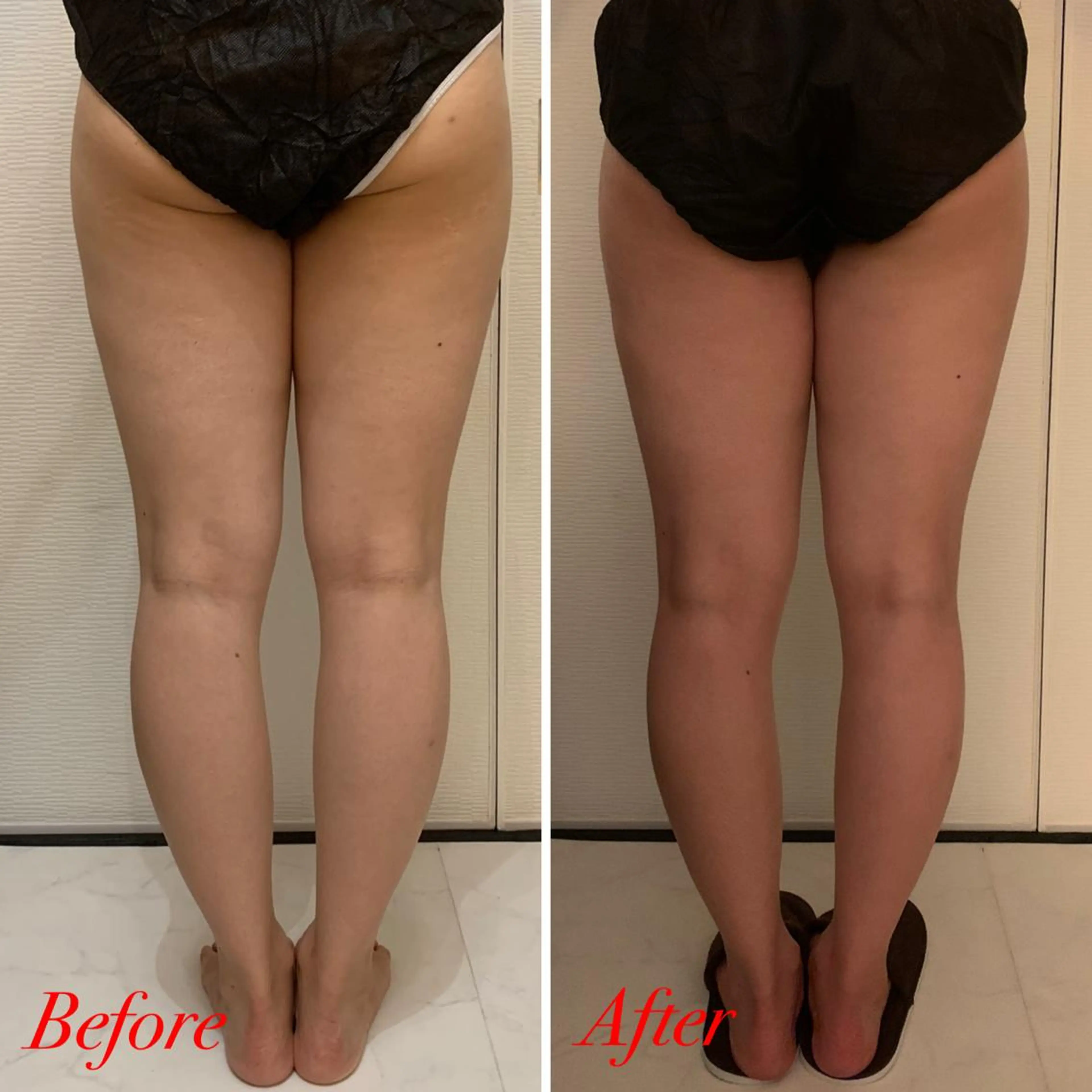 エステ リラク R.M所属・プライベートサロン R.Mのエステ・リラクイメージ