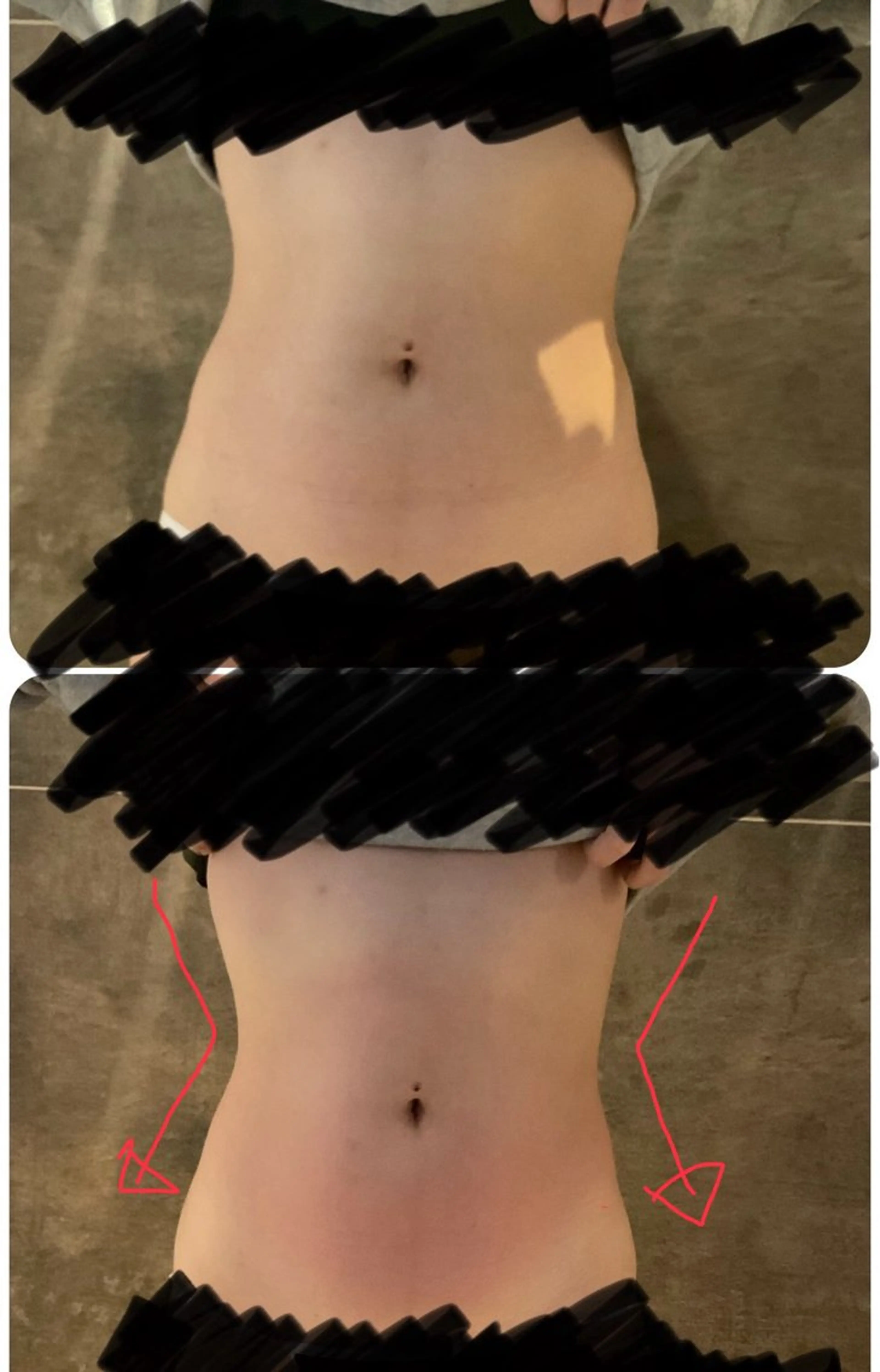 エステ 【痩身ダイエット・リンパオイルマッサージ・脱毛】- iromie. 四日市店 - 医療提携所属・佐々木 千愛来のエステ・リラクイメージ