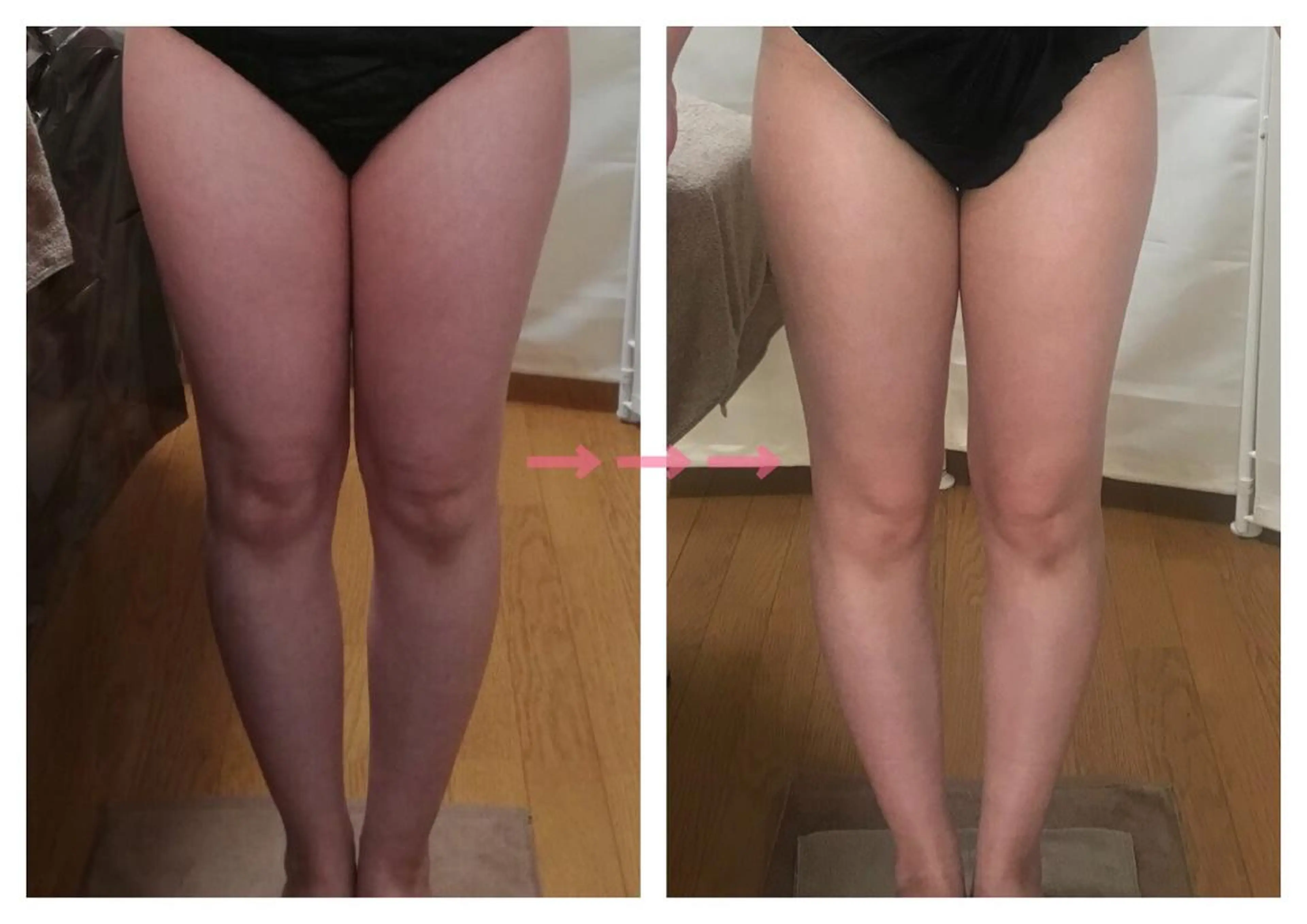 biloop所属・《痩身×疲労改善》 BILOOPのエステ・リラクイメージ