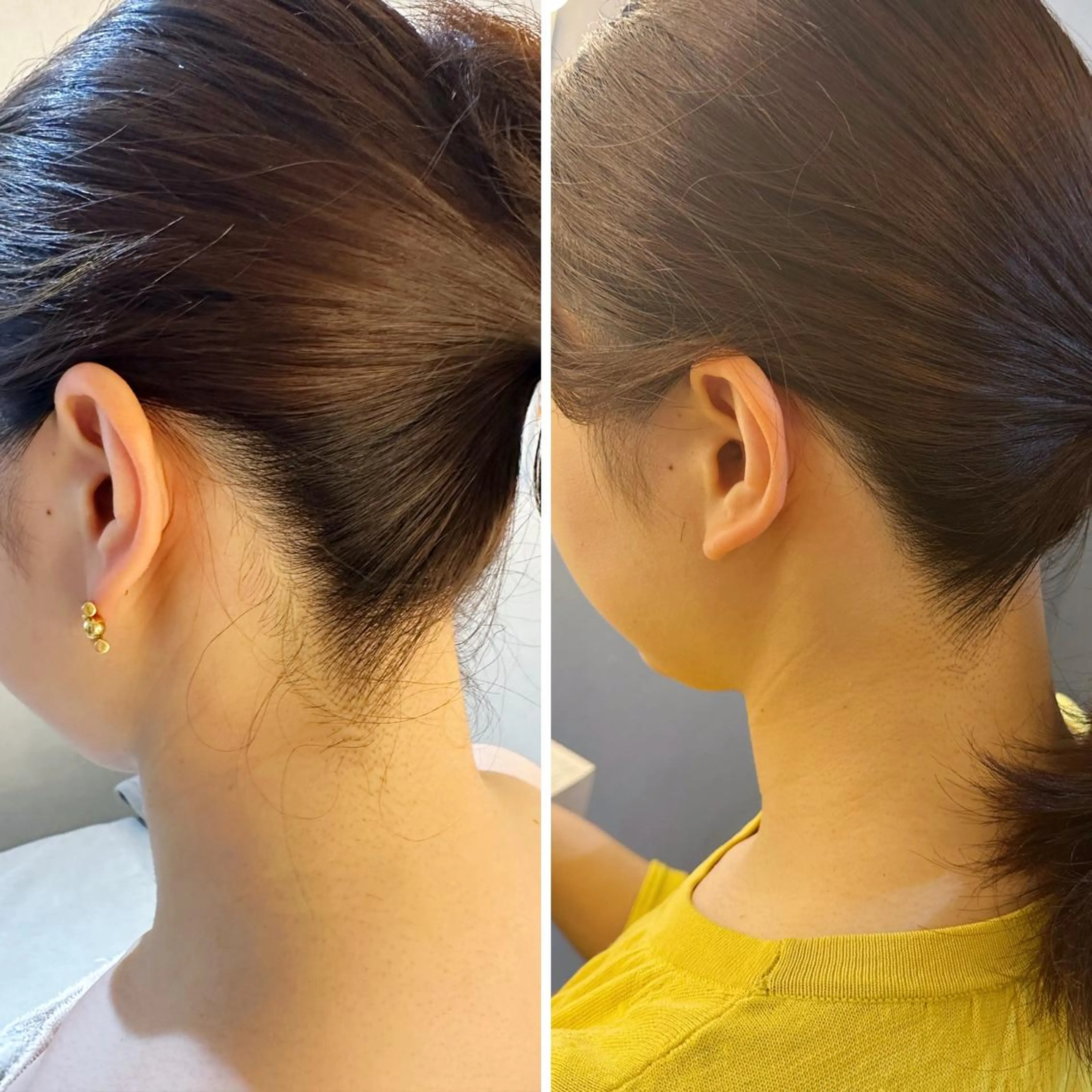 脱毛 うなじ脱毛/美肌脱毛 LABELのエステ・リラクイメージ