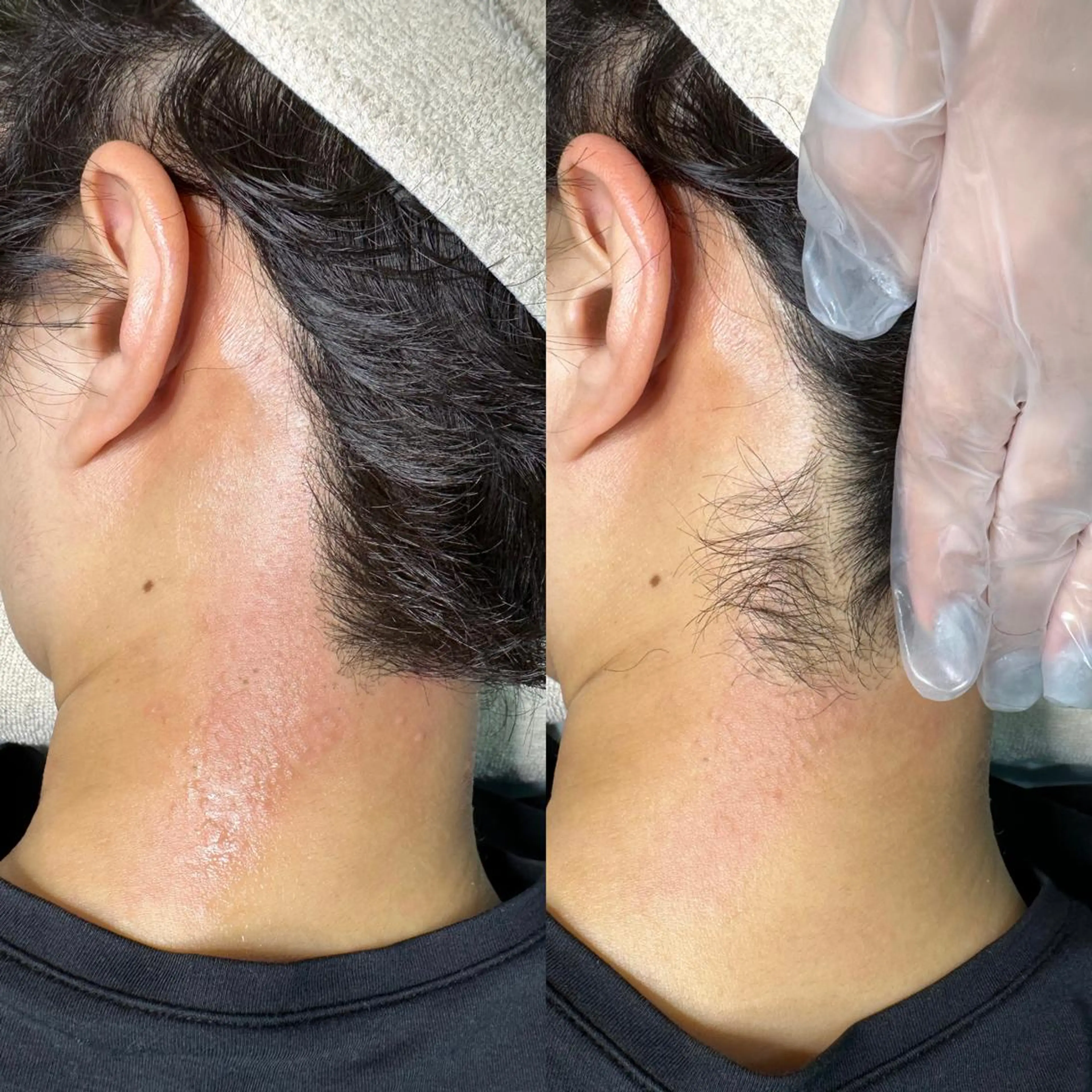 脱毛 WAX＆光脱毛 ESTHERIAのエステ・リラクイメージ