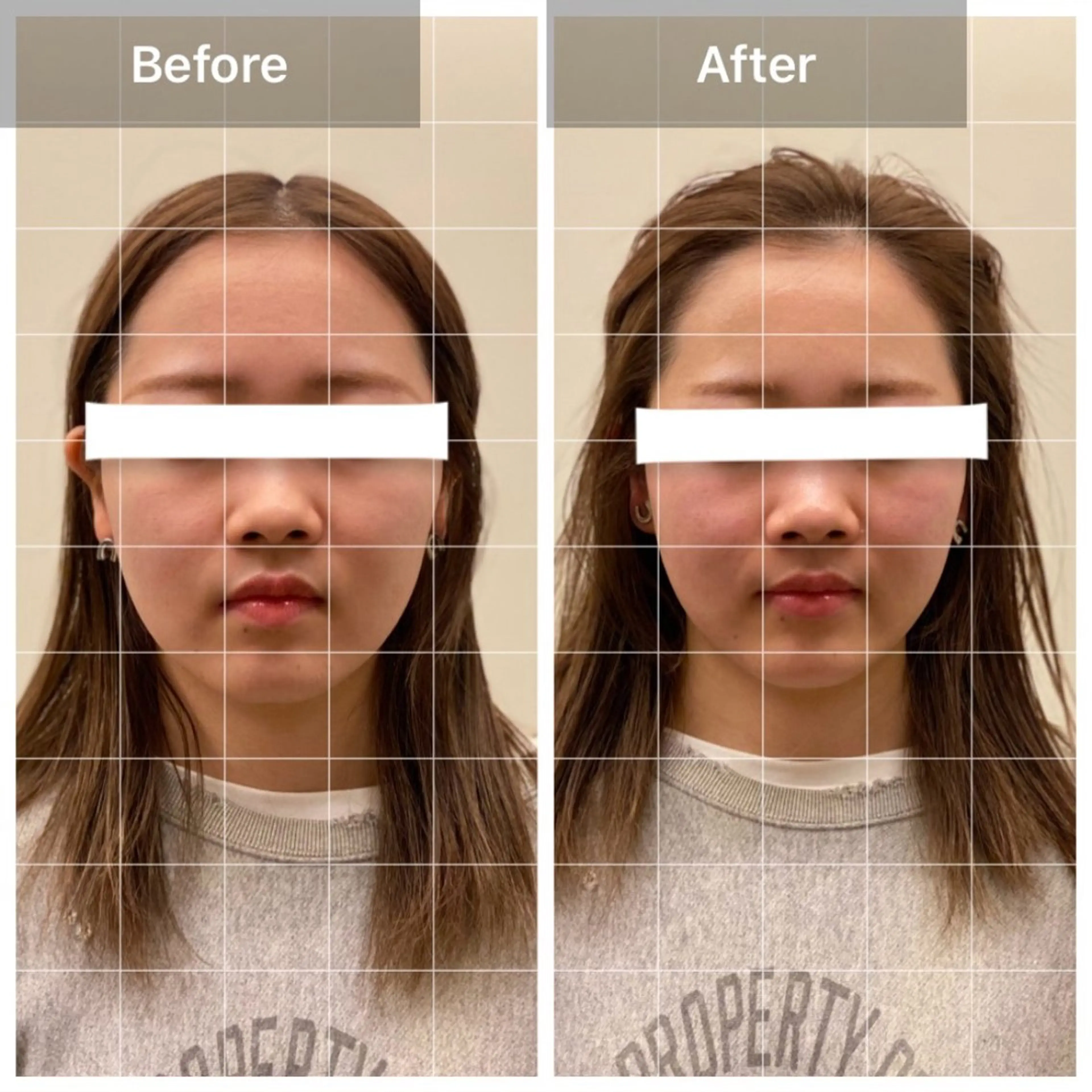 美容鍼/ヘッドスパ/ 💎さかもとのエステ・リラクイメージ