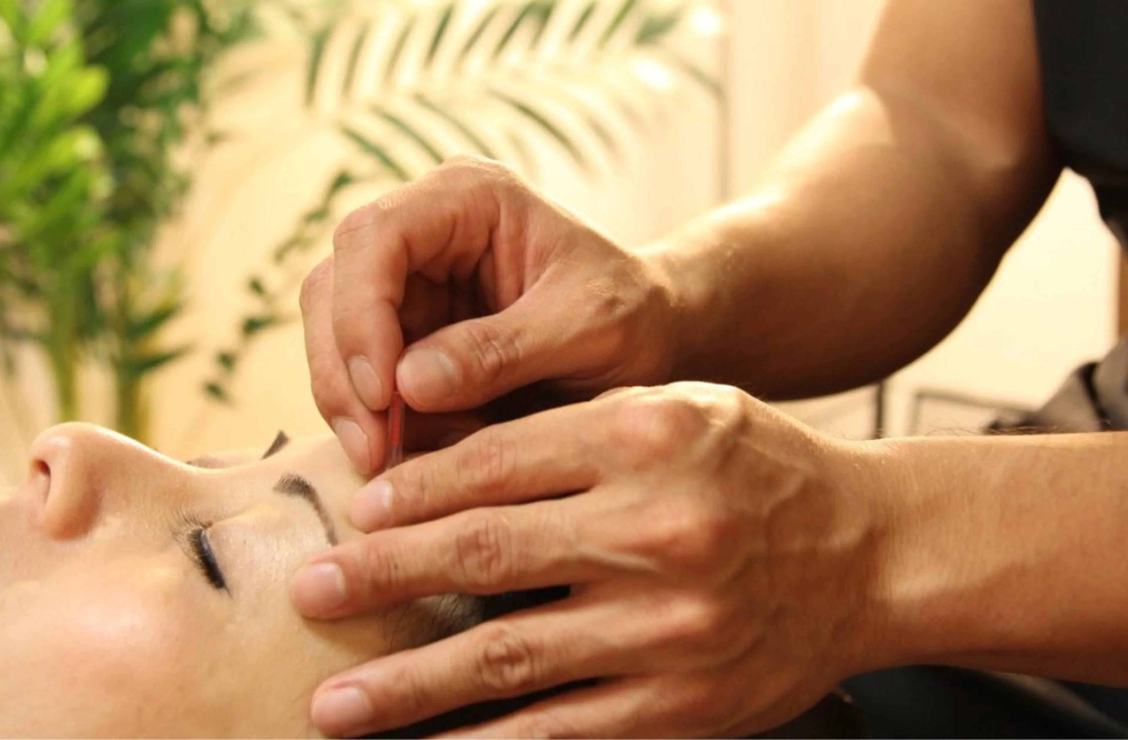 【初回限定20%OFF】美容鍼30分の写真