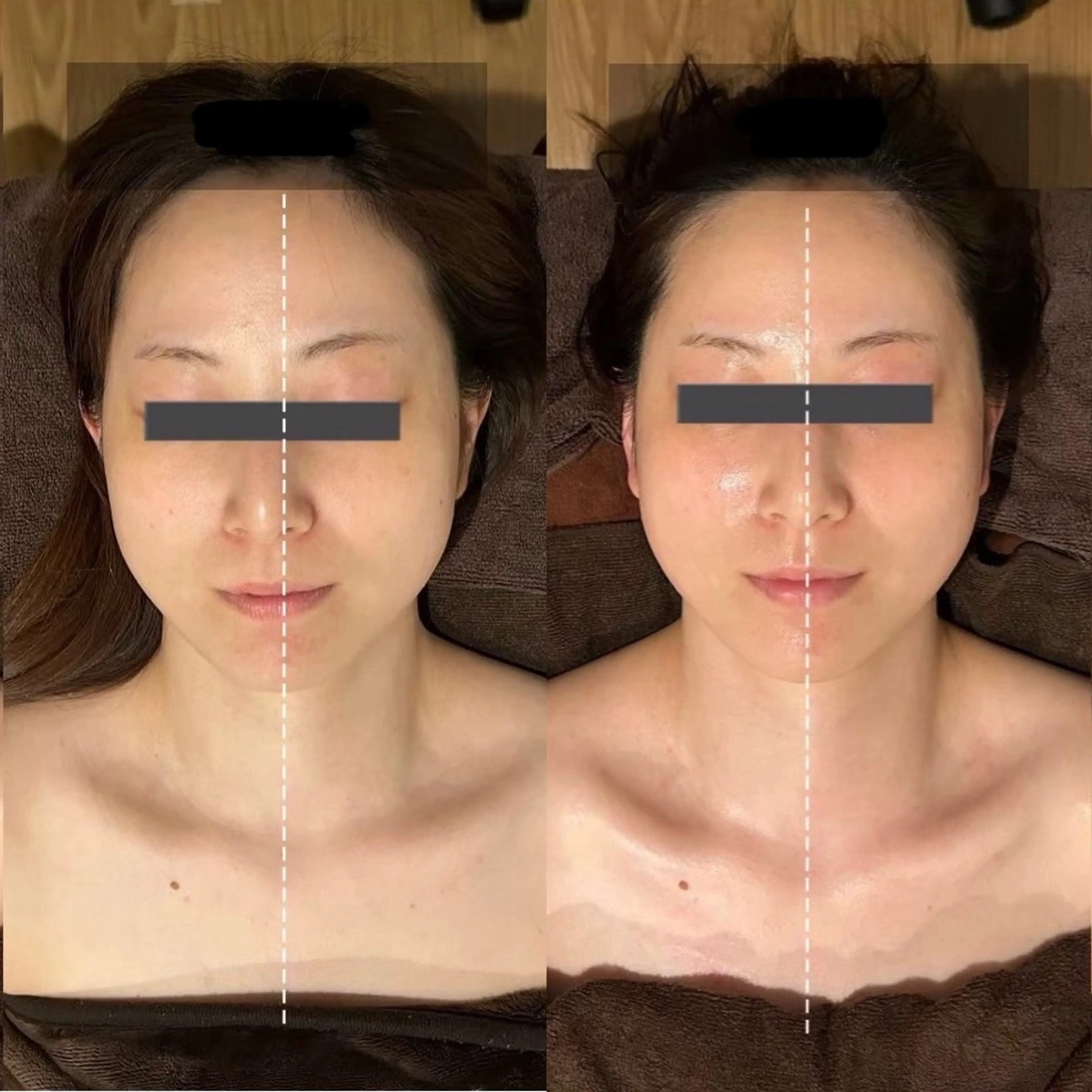 ニキビ･毛穴悩み特化 /CHISATOのエステ・リラクイメージ