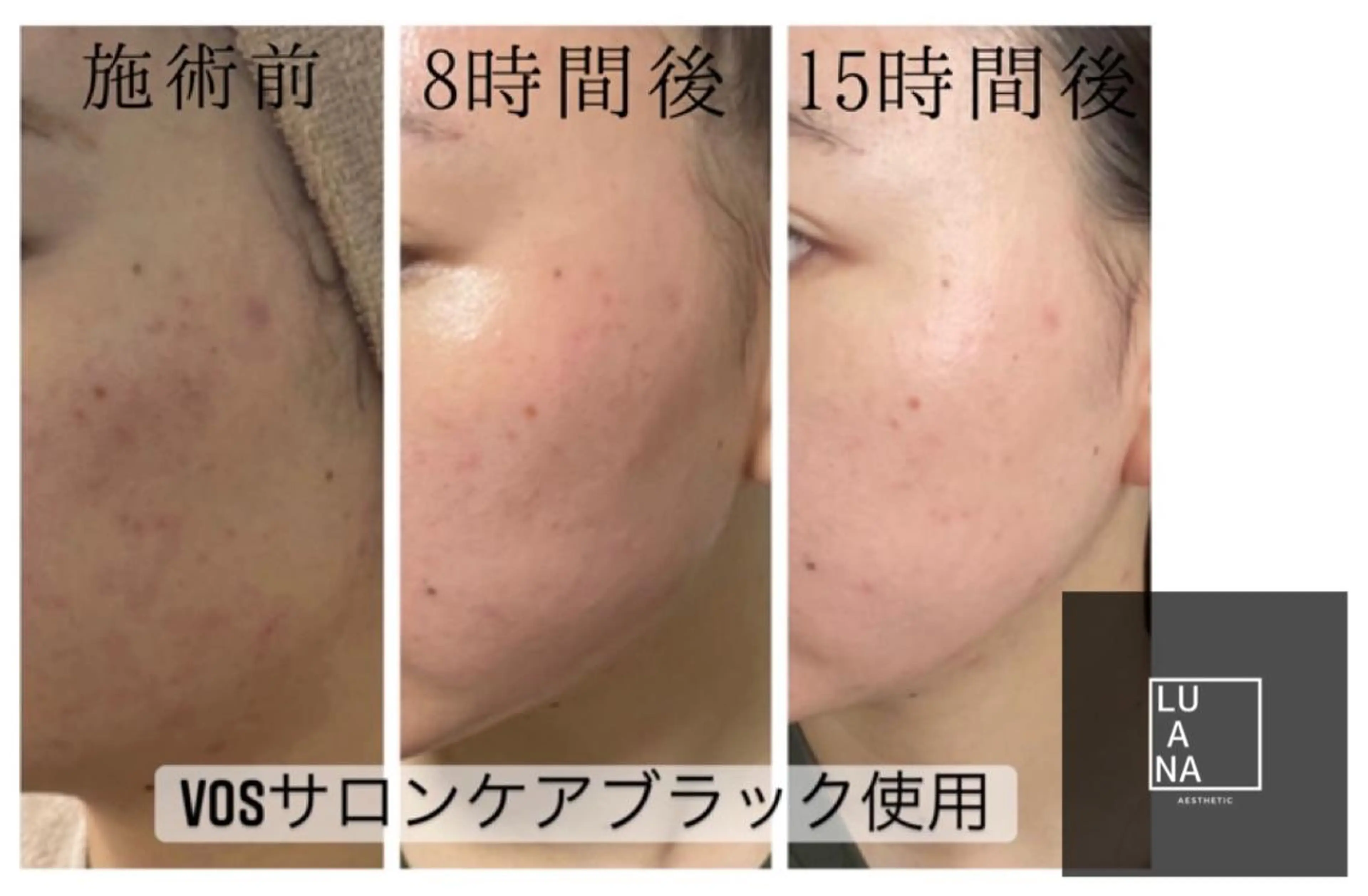 エステ LUANA TAKAGIの眉毛・アイブロウイメージ