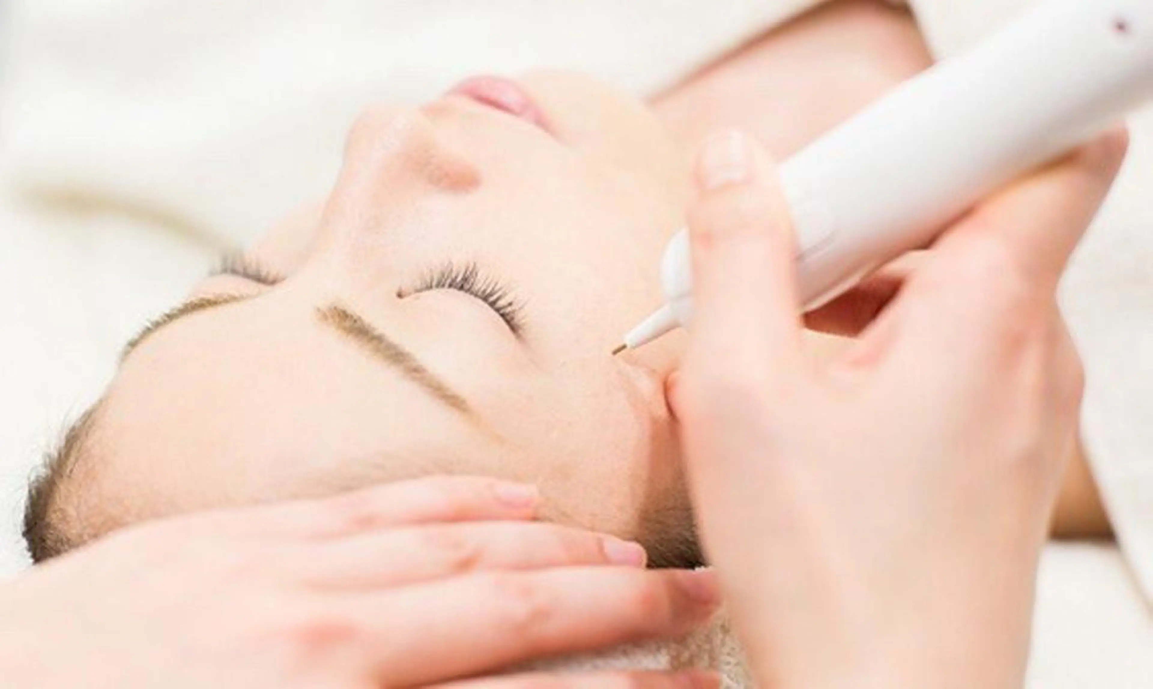 シミショット打ち放題✨アフターケア付き￥22000→の写真