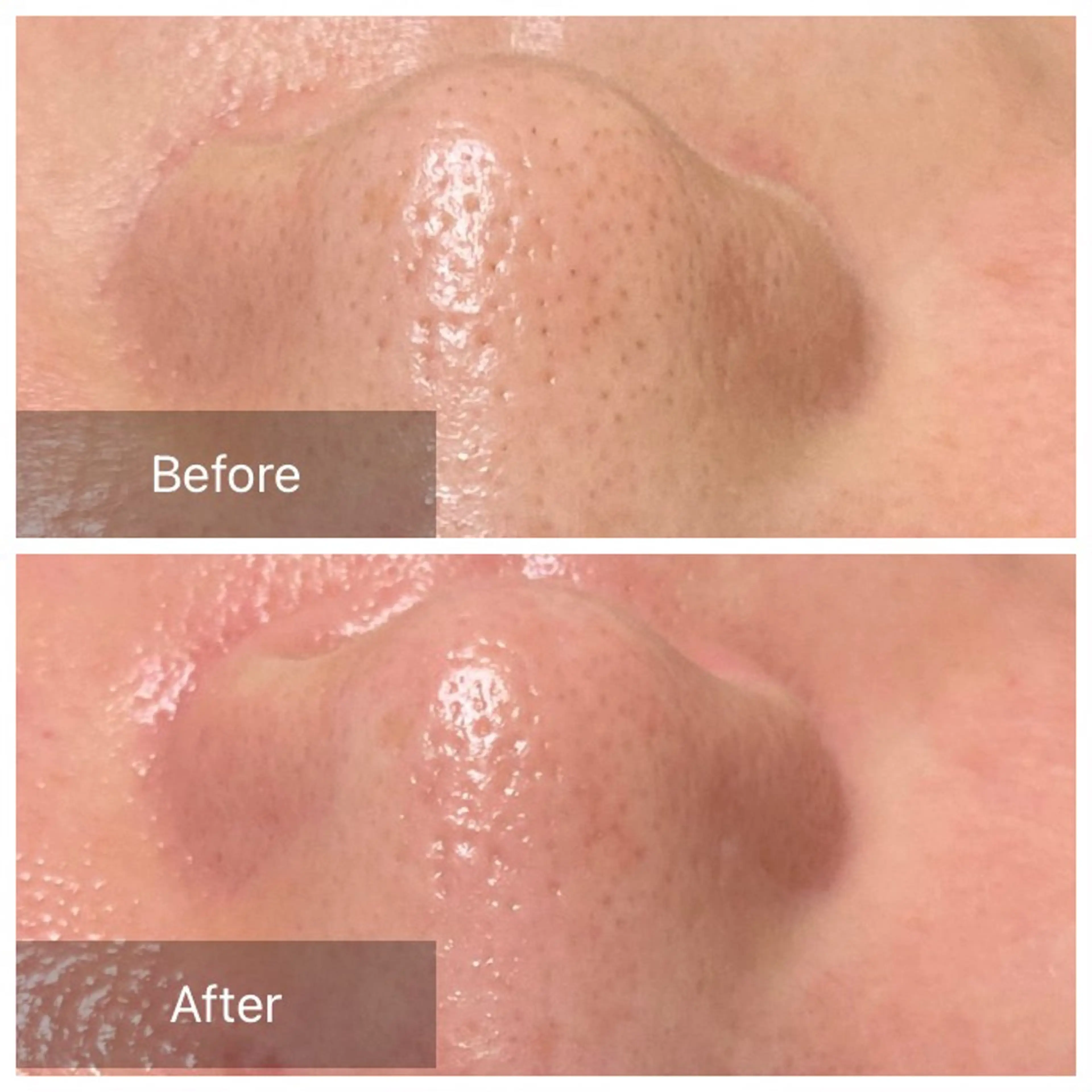 脱毛 産毛専門店 Bittoのエステ・リラクイメージ