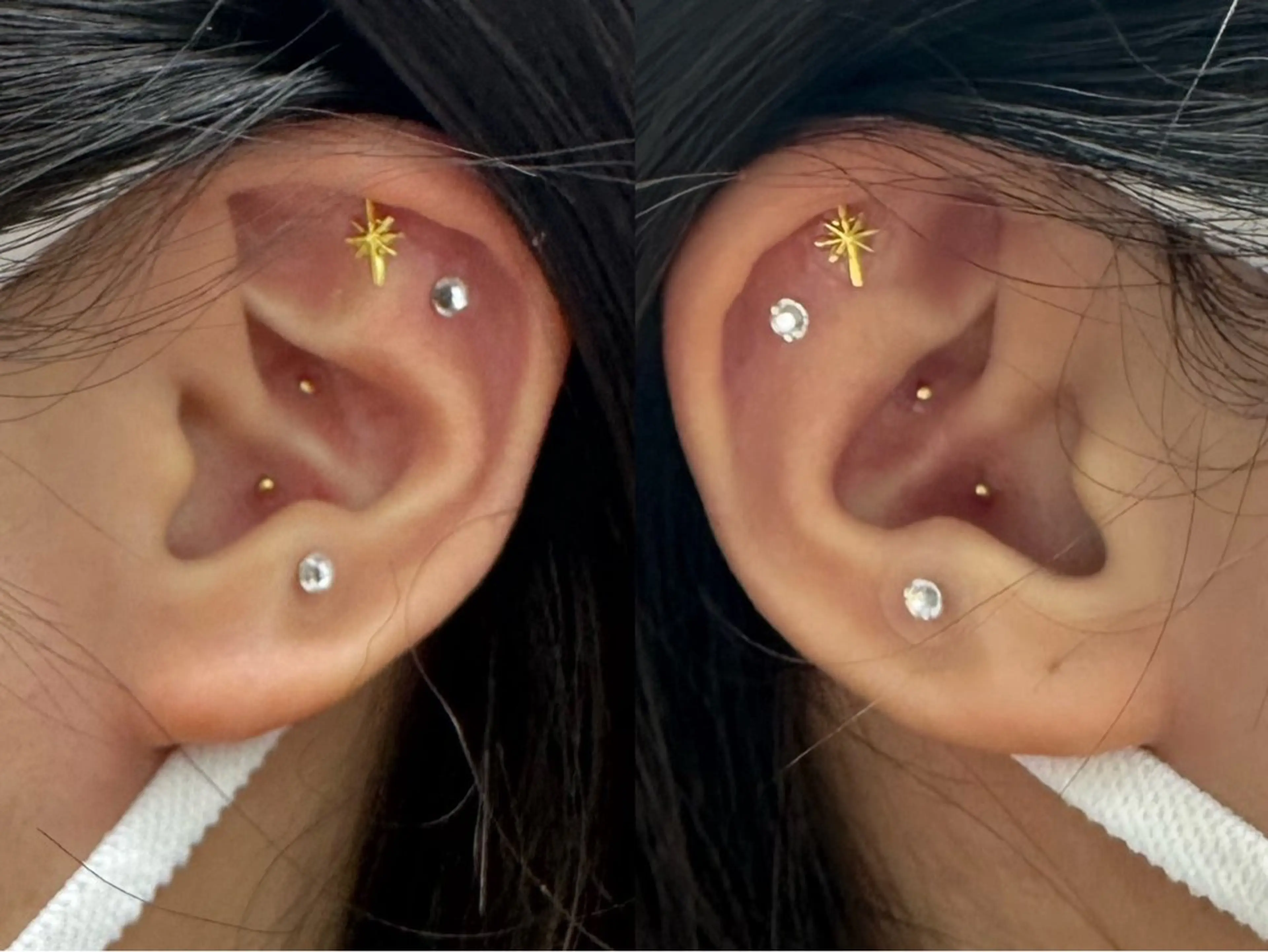 ◯△□所属・最新美肌脱毛 韓国水光肌🫧のその他イメージ