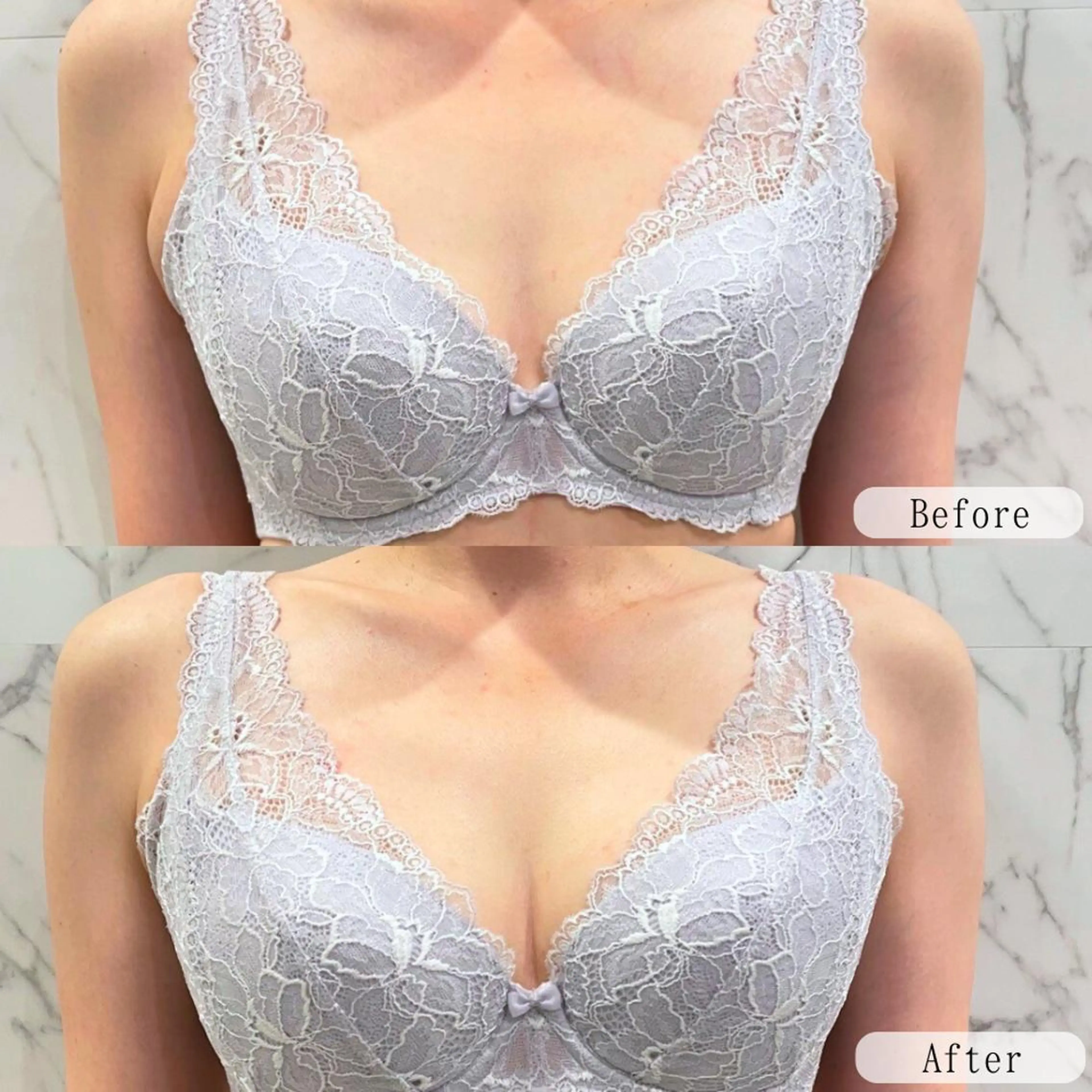 最新機器で速攻ハリ実感!ふっくらバストアップ体験 ¥20,000→¥4,800の写真