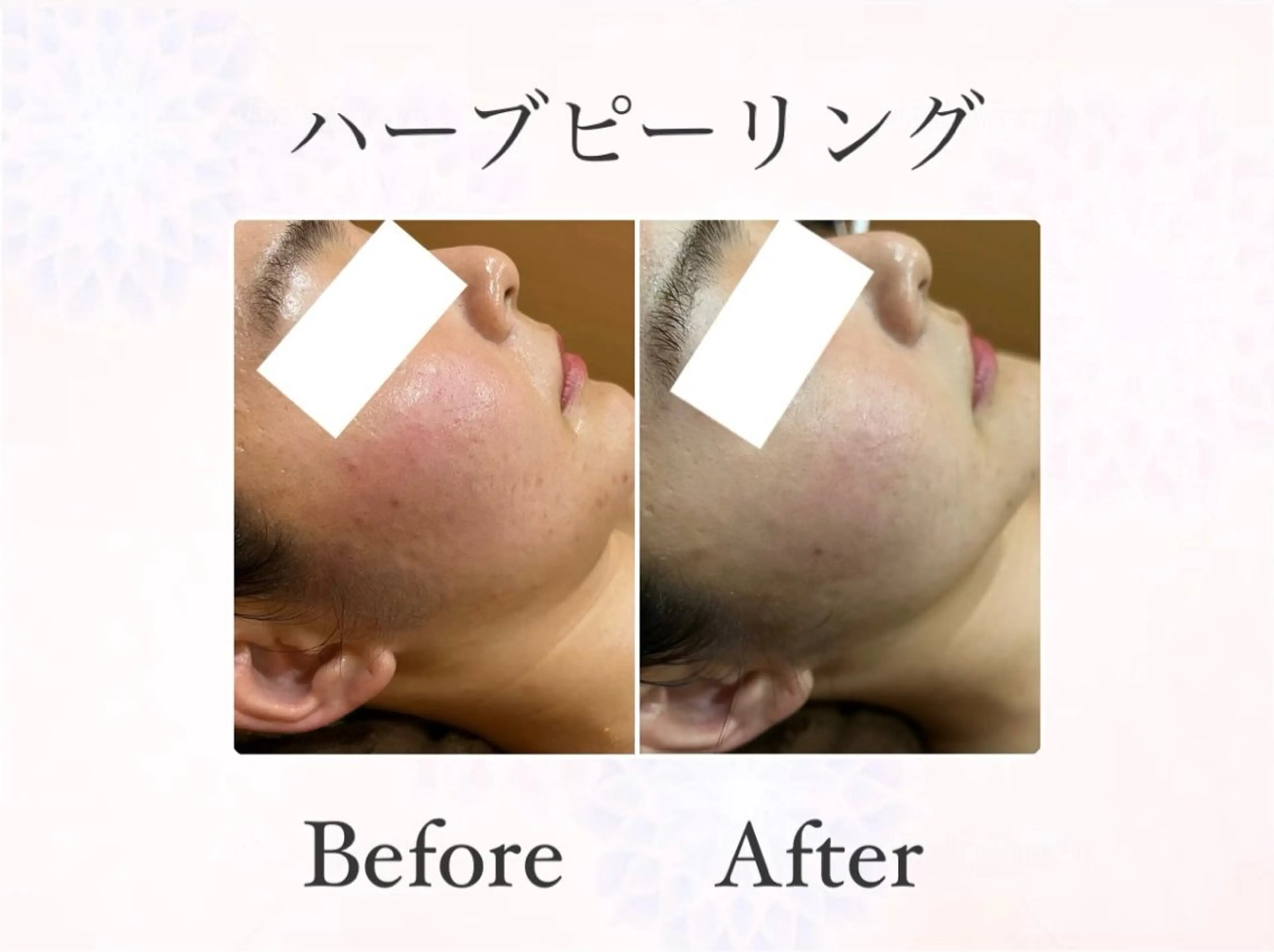 ハーブピーリング専門 muro.のエステ・リラクイメージ