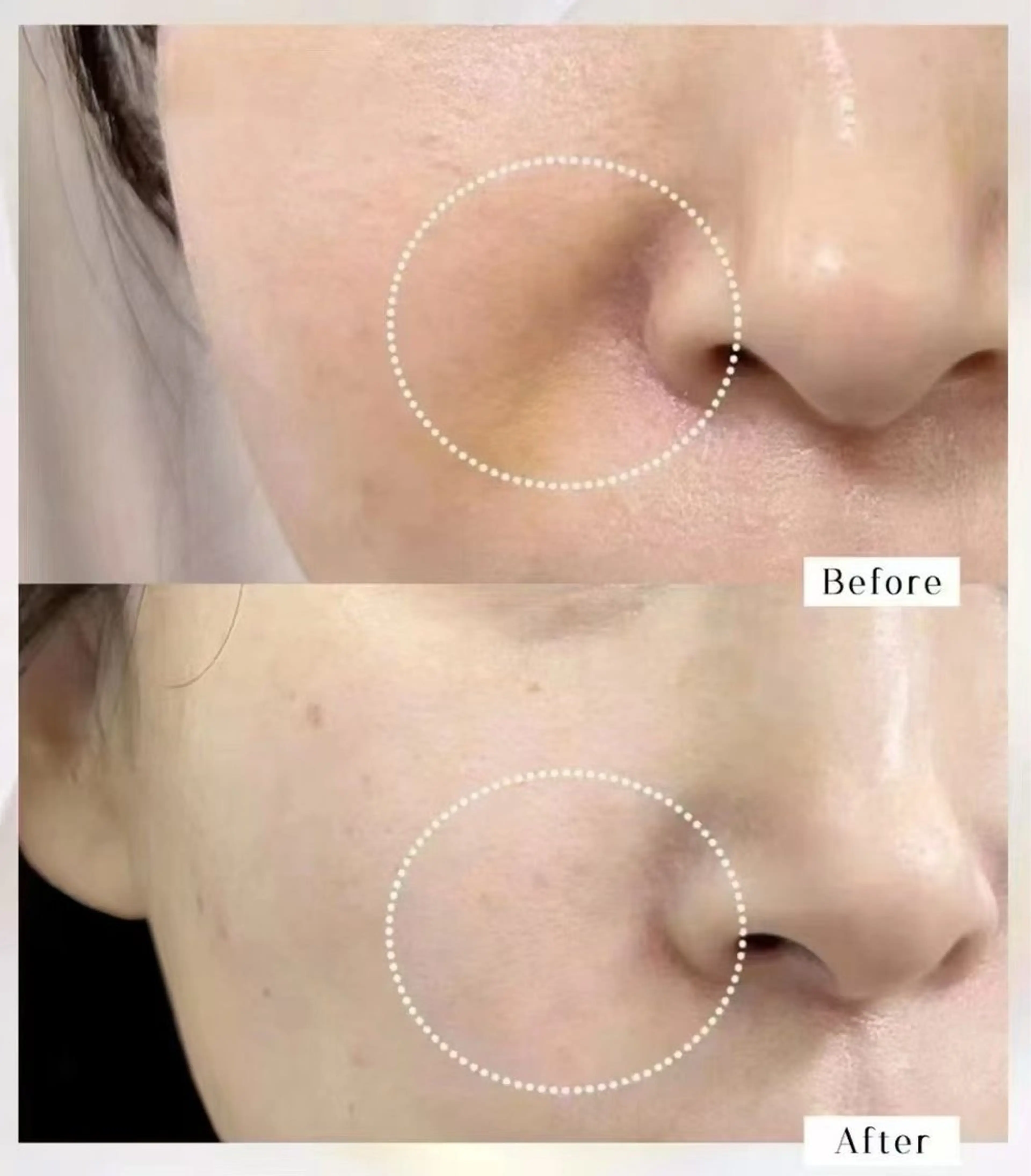 ショート エステ aliaハイフ&水光ジェットサロン所属・aliaハーブ水光店 エステティシャン募集のエステ・リラクイメージ