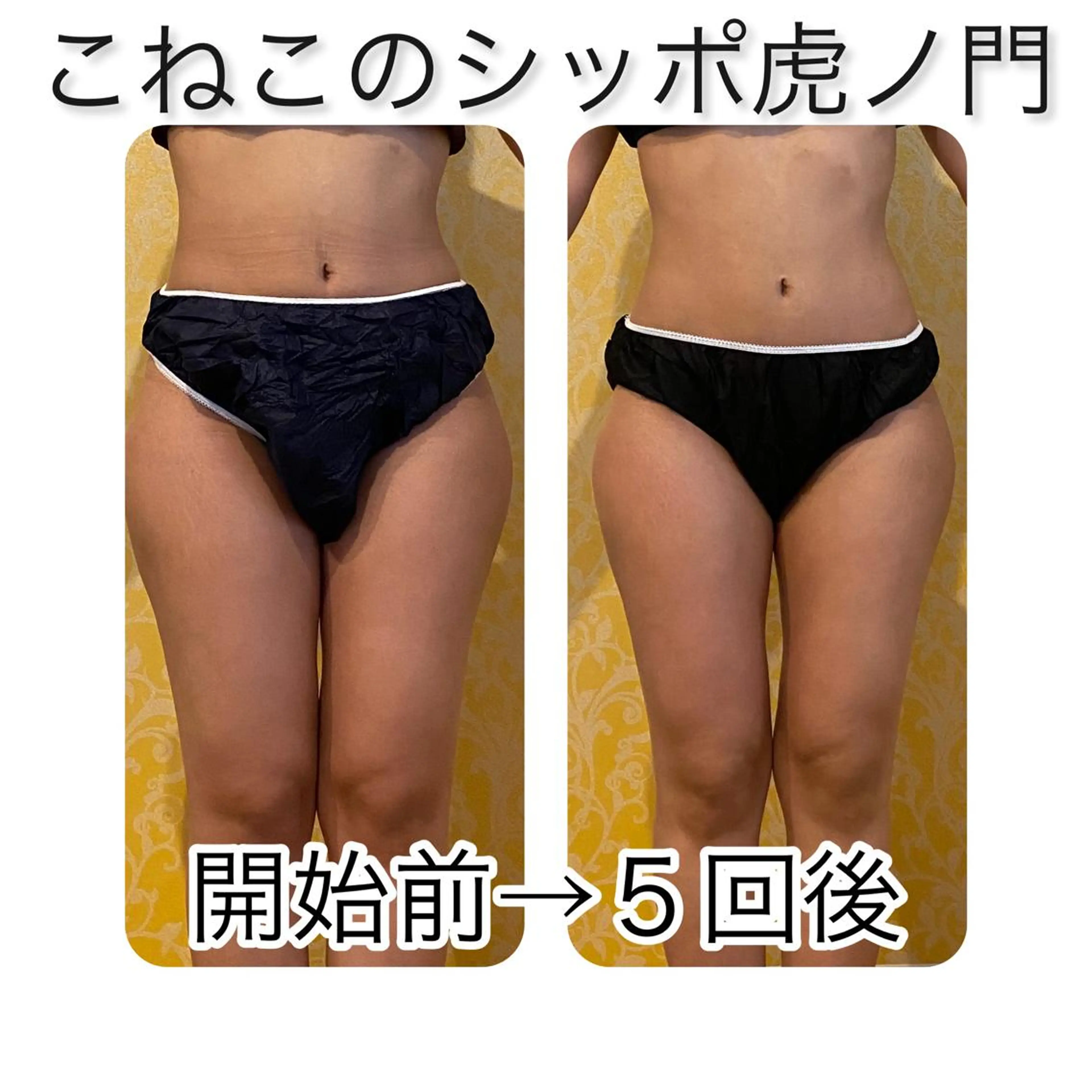 くびれ作り専門サロン こねこのシッポ虎ノ門のエステ・リラクイメージ