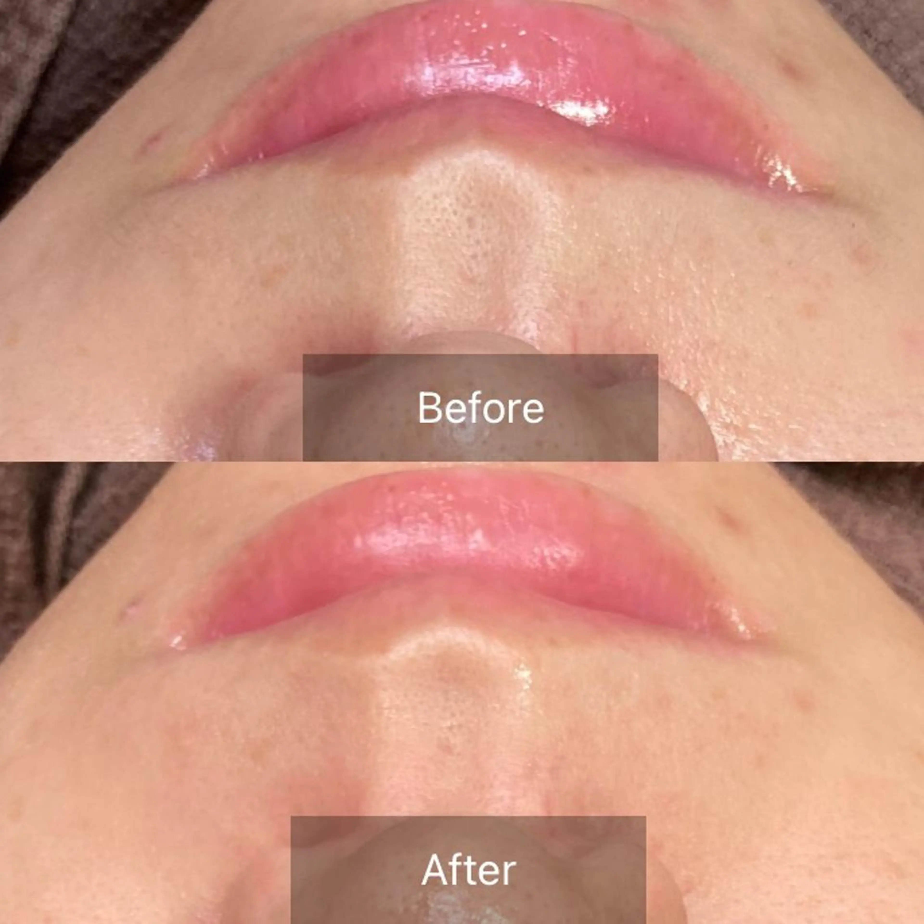 エステ 産毛専門店 Bittoのエステ・リラクイメージ